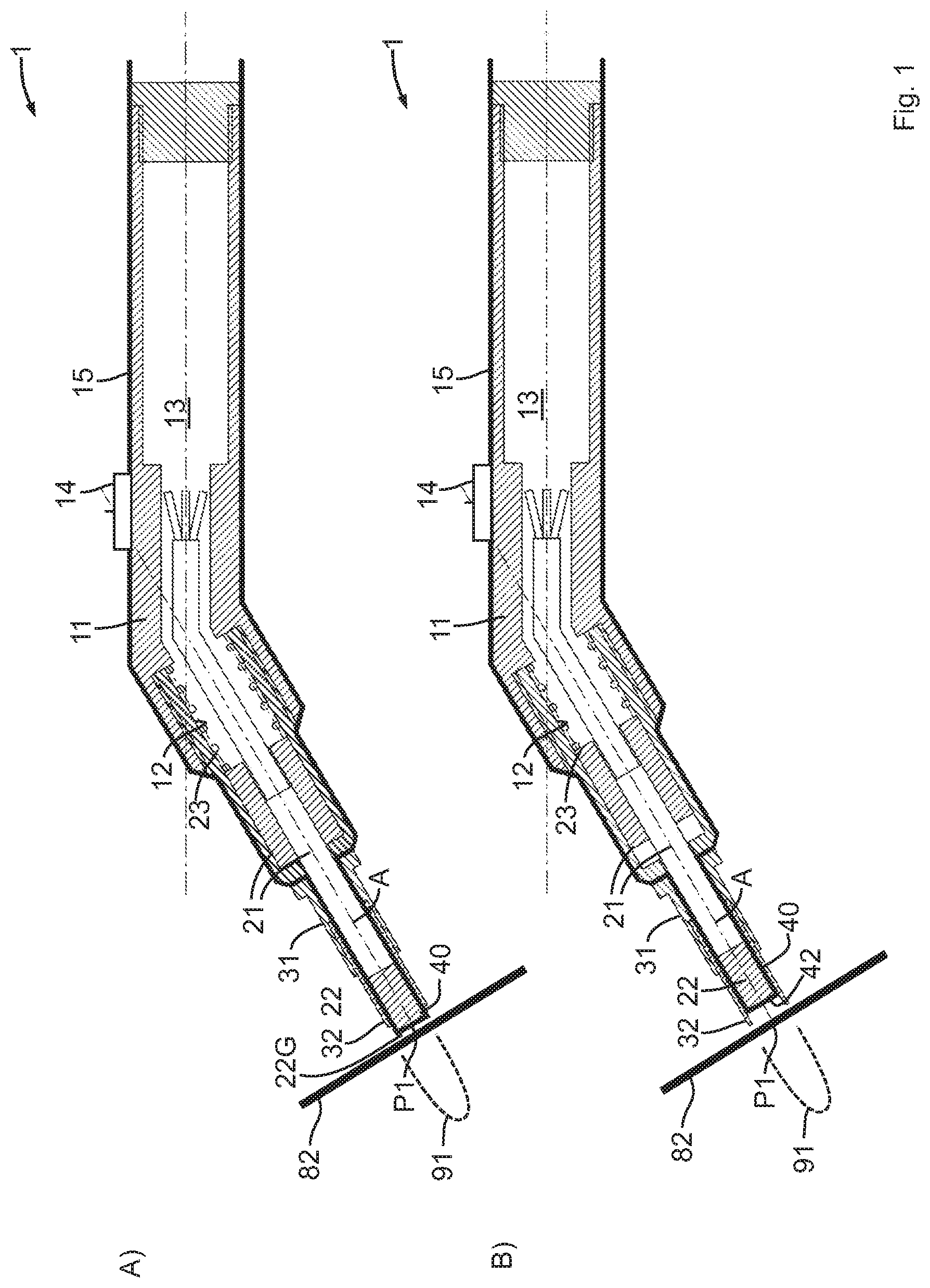 Patent US11779433 — Device for exposing an implant base body — Figure 1