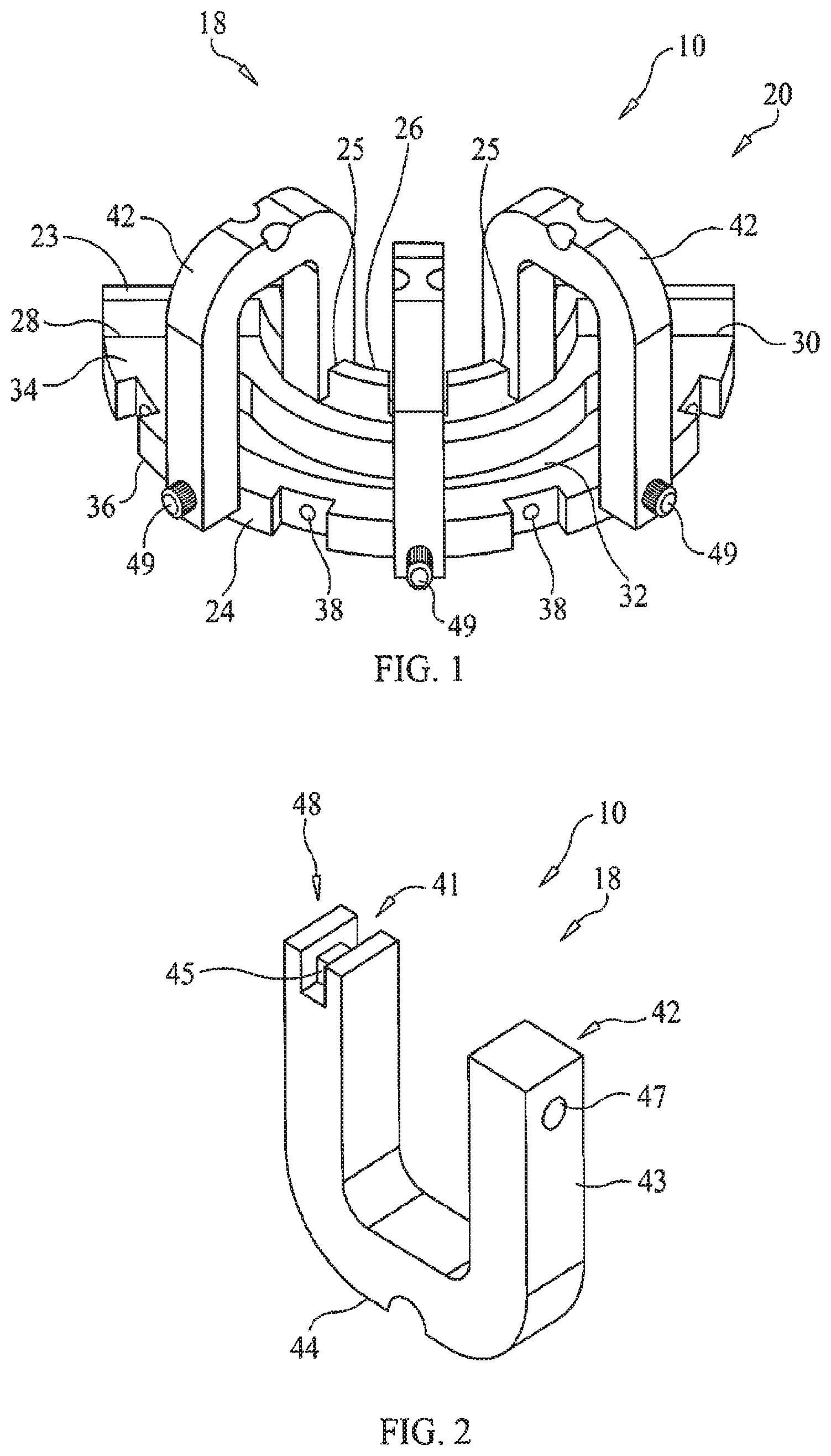 Patent US11779434 — Bone foundation guide system and method — Figure 1