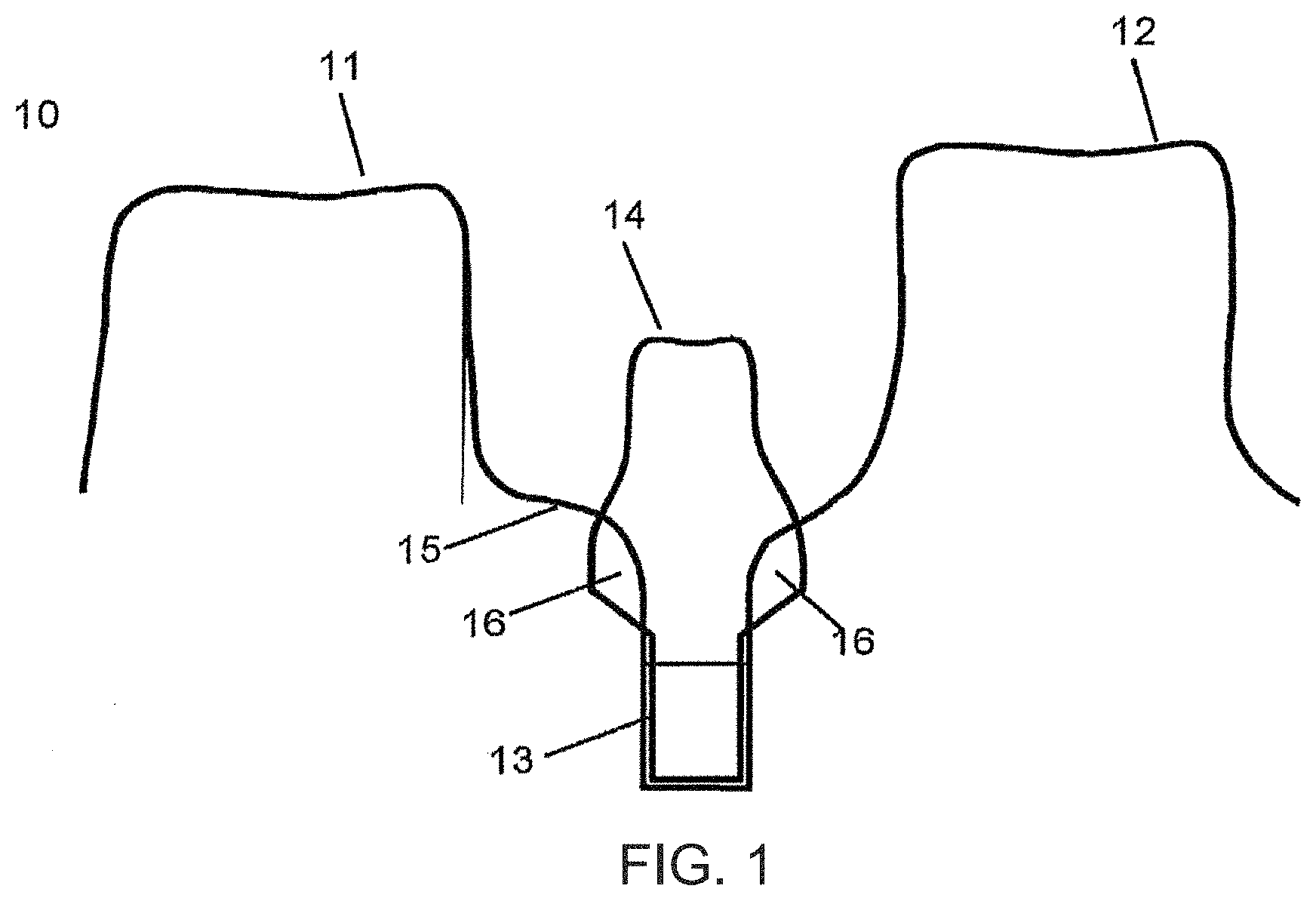 Patent US11779440 — Method of modifying the gingival part of a virtual model of a set of teeth — Figure 1