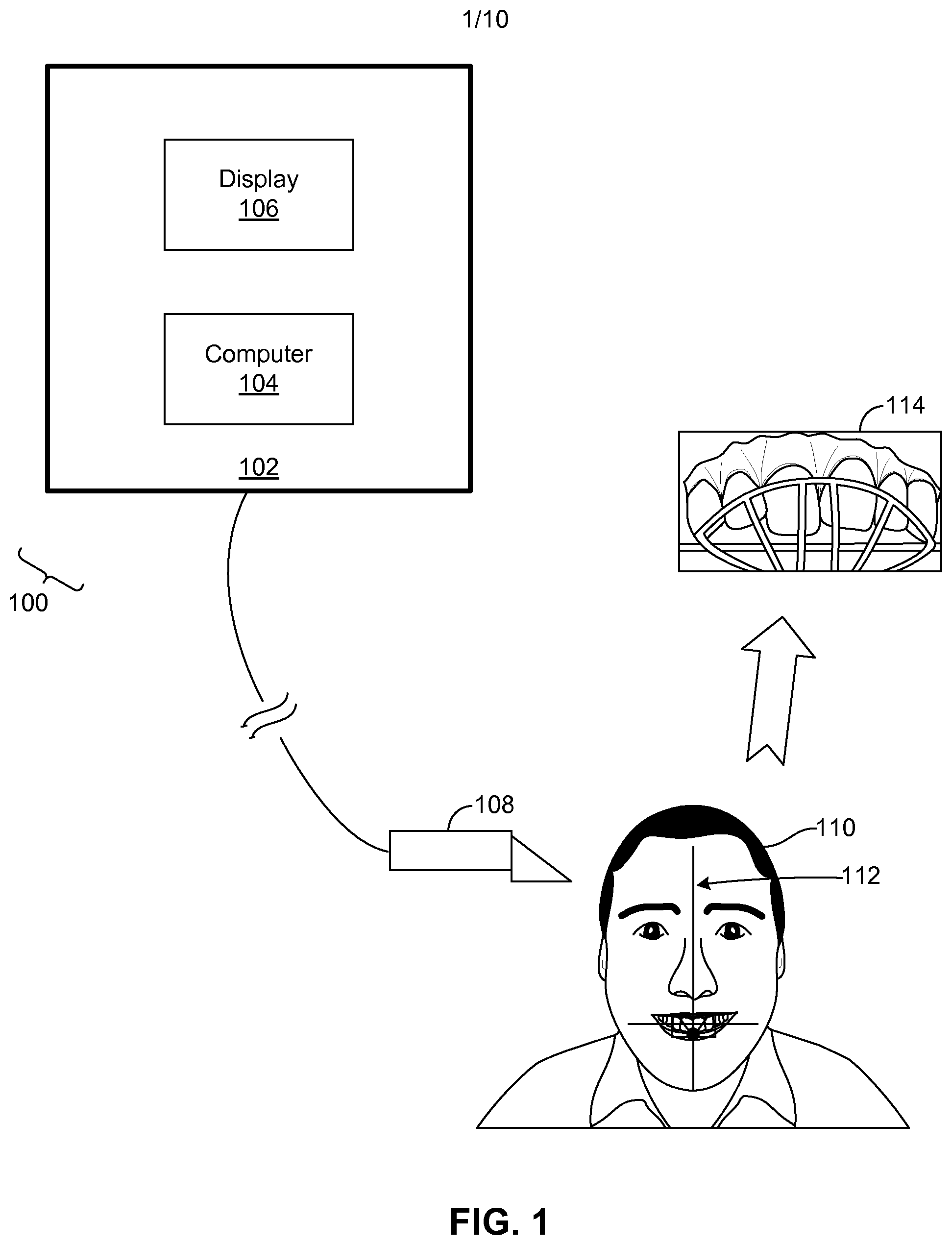 Patent US11779444 Figure 1 – Methods and systems for dental procedures