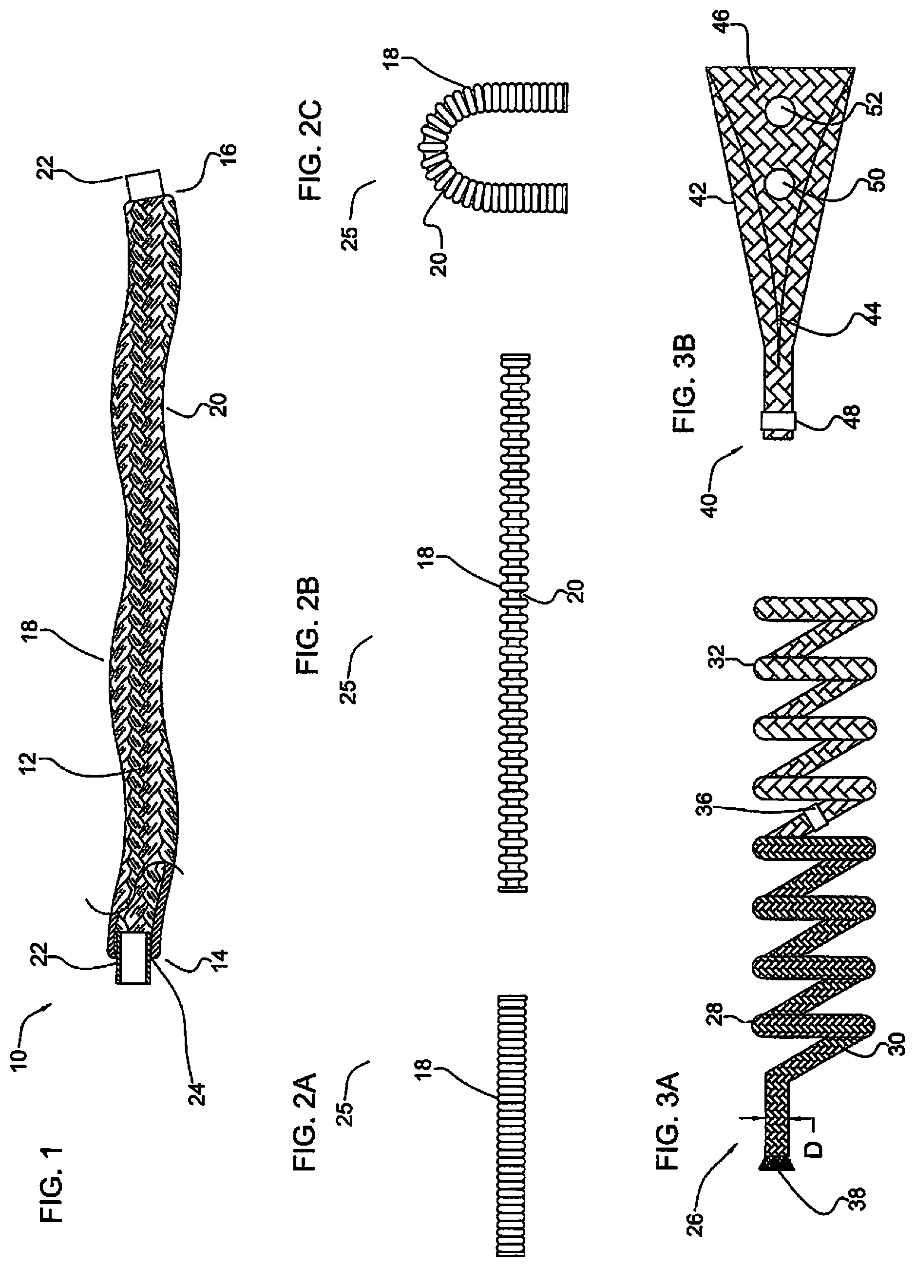 Patent US11779452 — Vascular implant — Figure 1