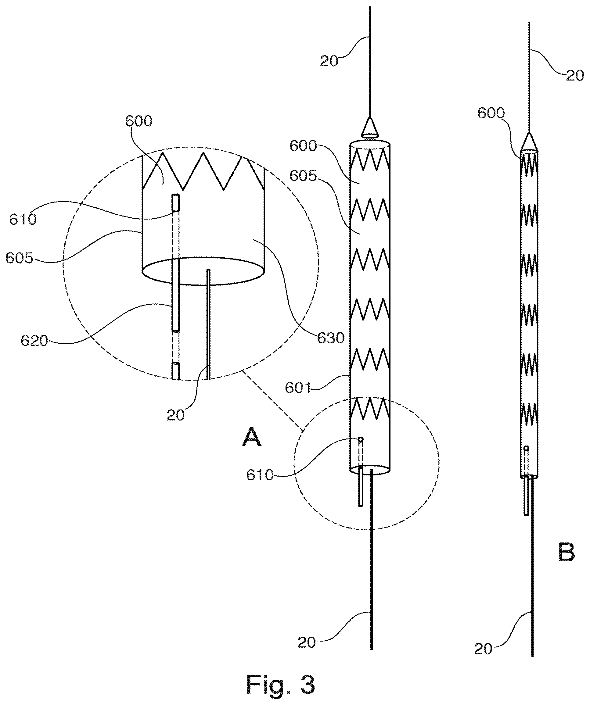 Patent US11779453 Figure 2 – Stent-graft prosthesis, system and method for improved delivery of a stent-graft prosthesis