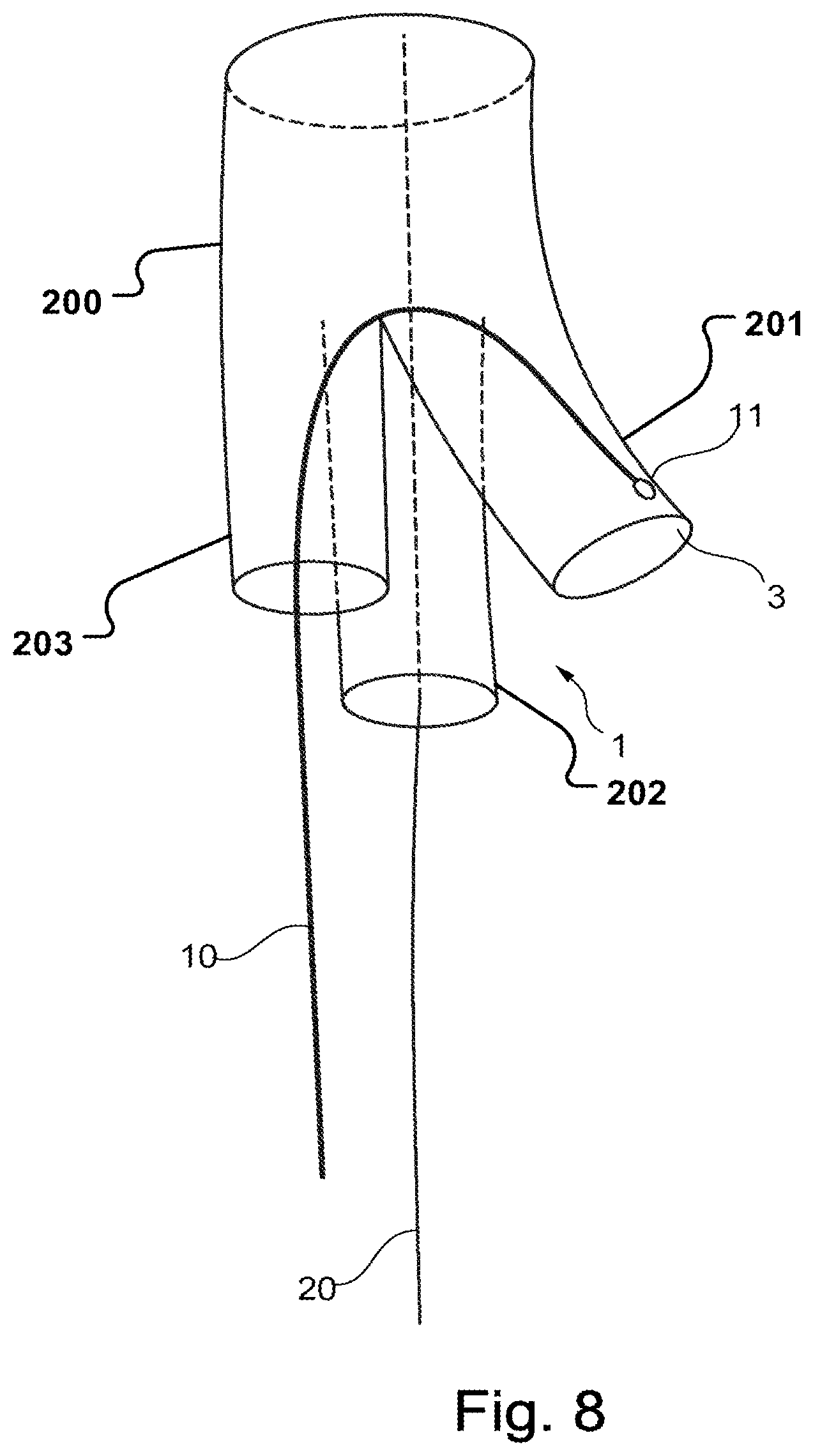 Patent US11779453 Figure 6 – Stent-graft prosthesis, system and method for improved delivery of a stent-graft prosthesis
