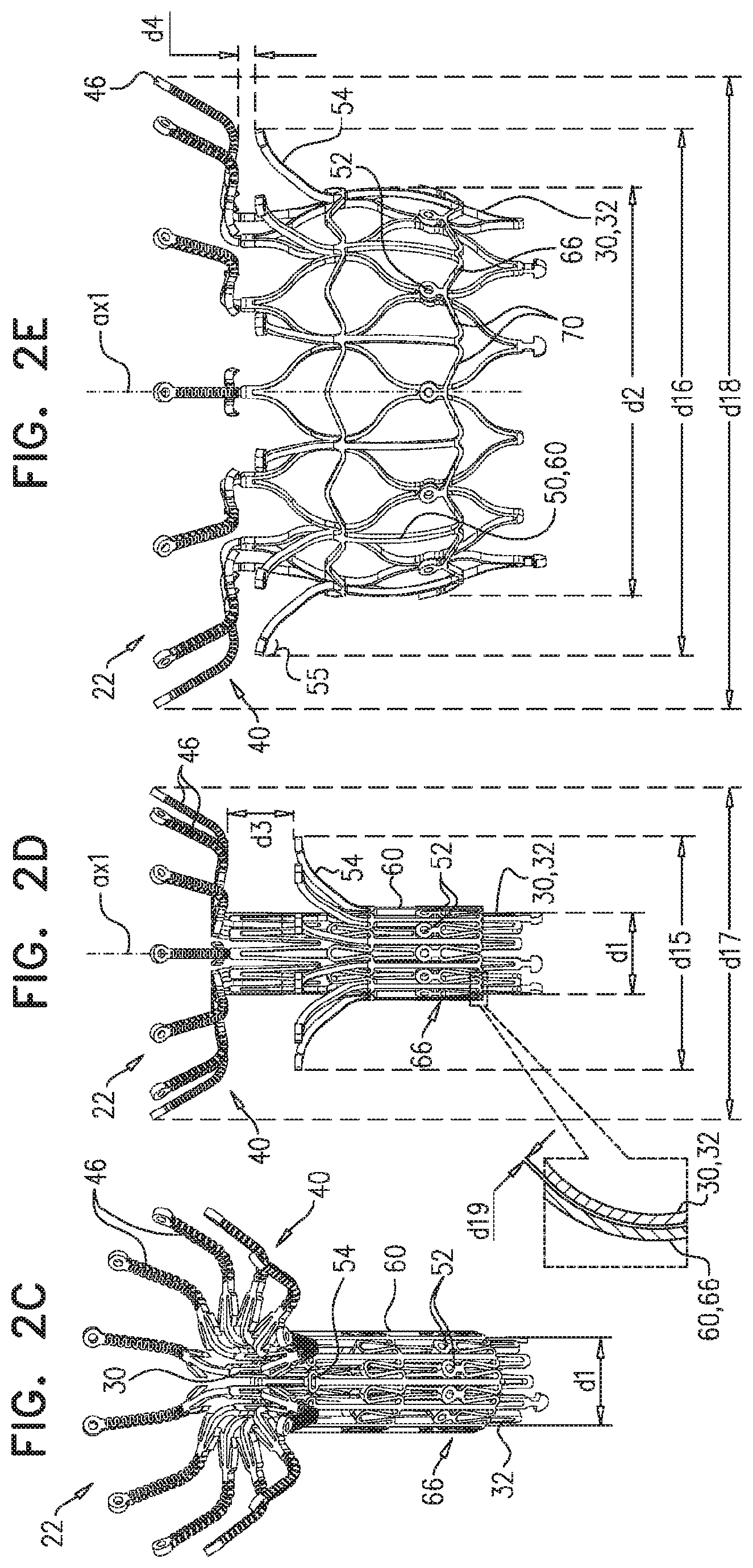Patent US11779458 Figure 3 – Prosthetic valve with leaflet connectors