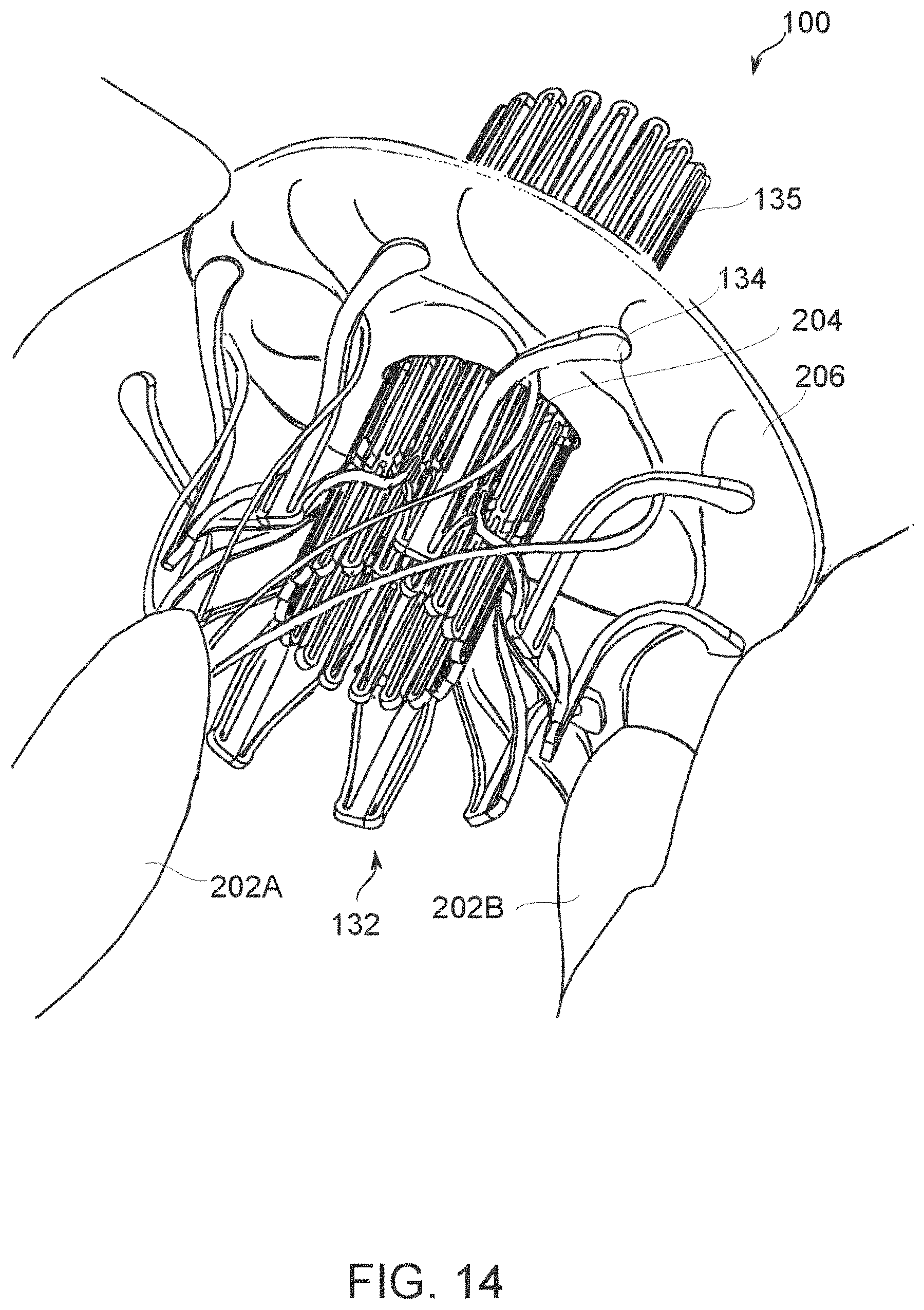 Patent US11779459 Figure 18 – Frame for prosthetic valve