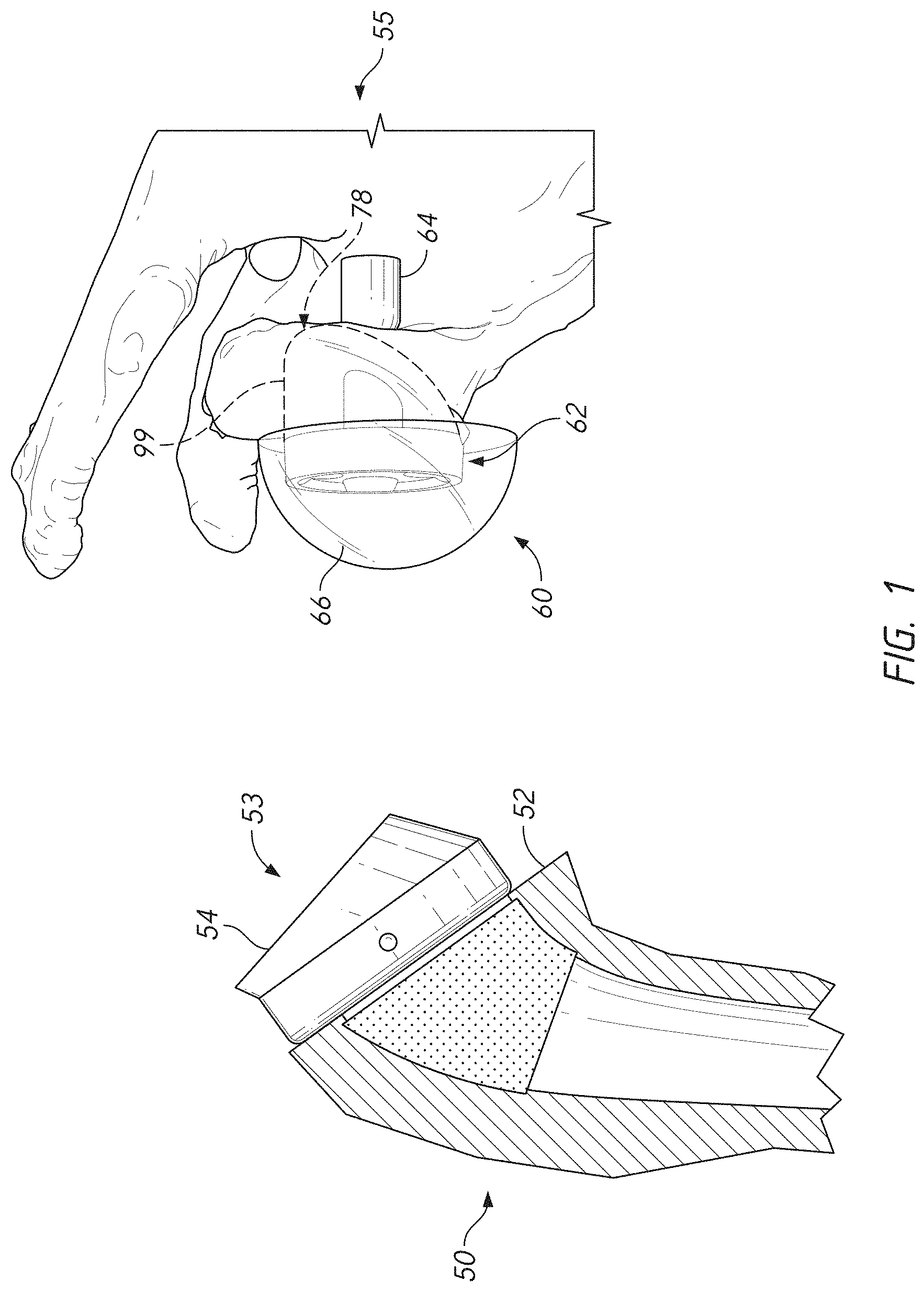 Patent US11779471 — Apparatuses and methods for implanting glenoid prostheses — Figure 1