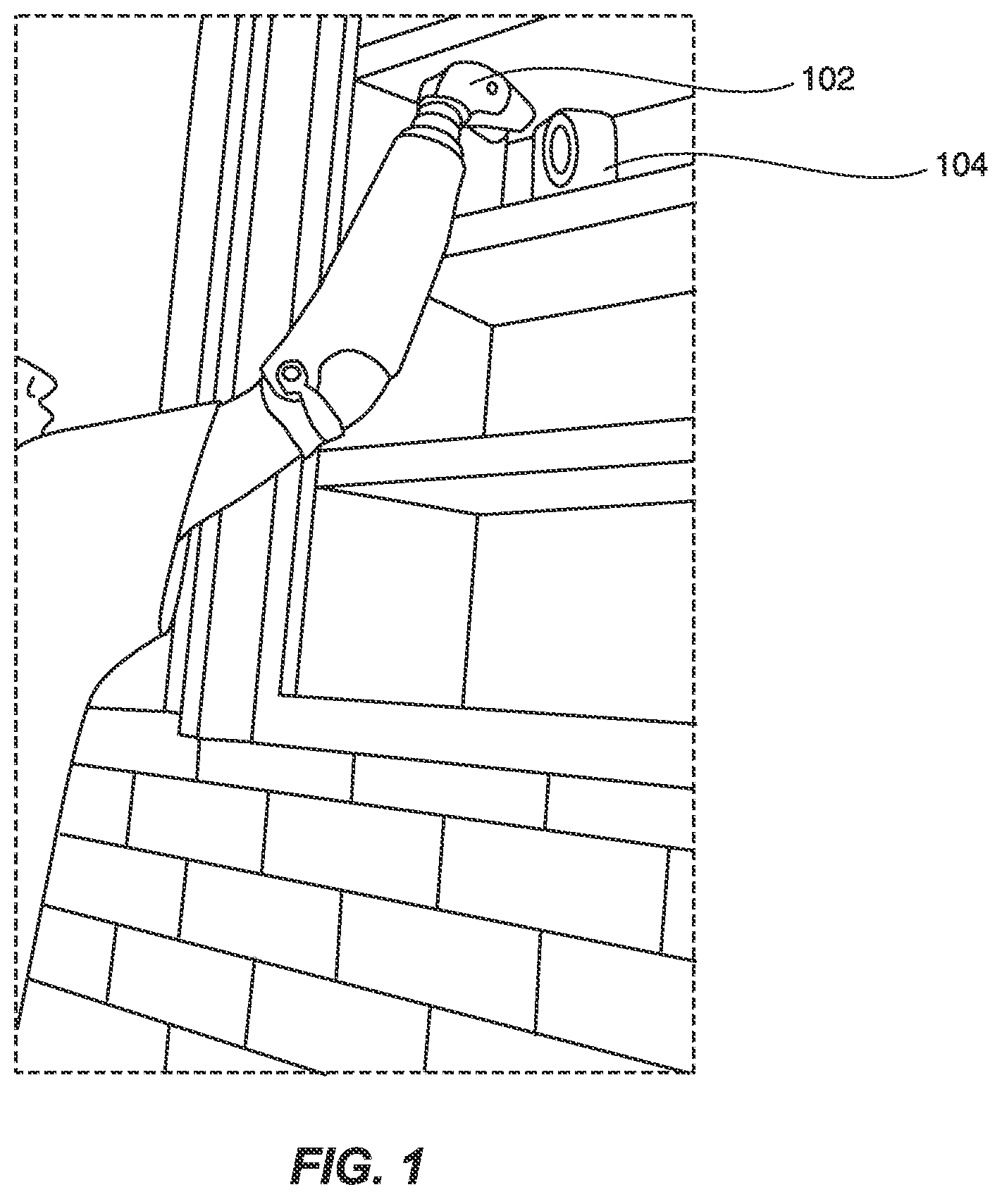 Patent US11779473 Figure 1 – Powered prosthetic flexion device