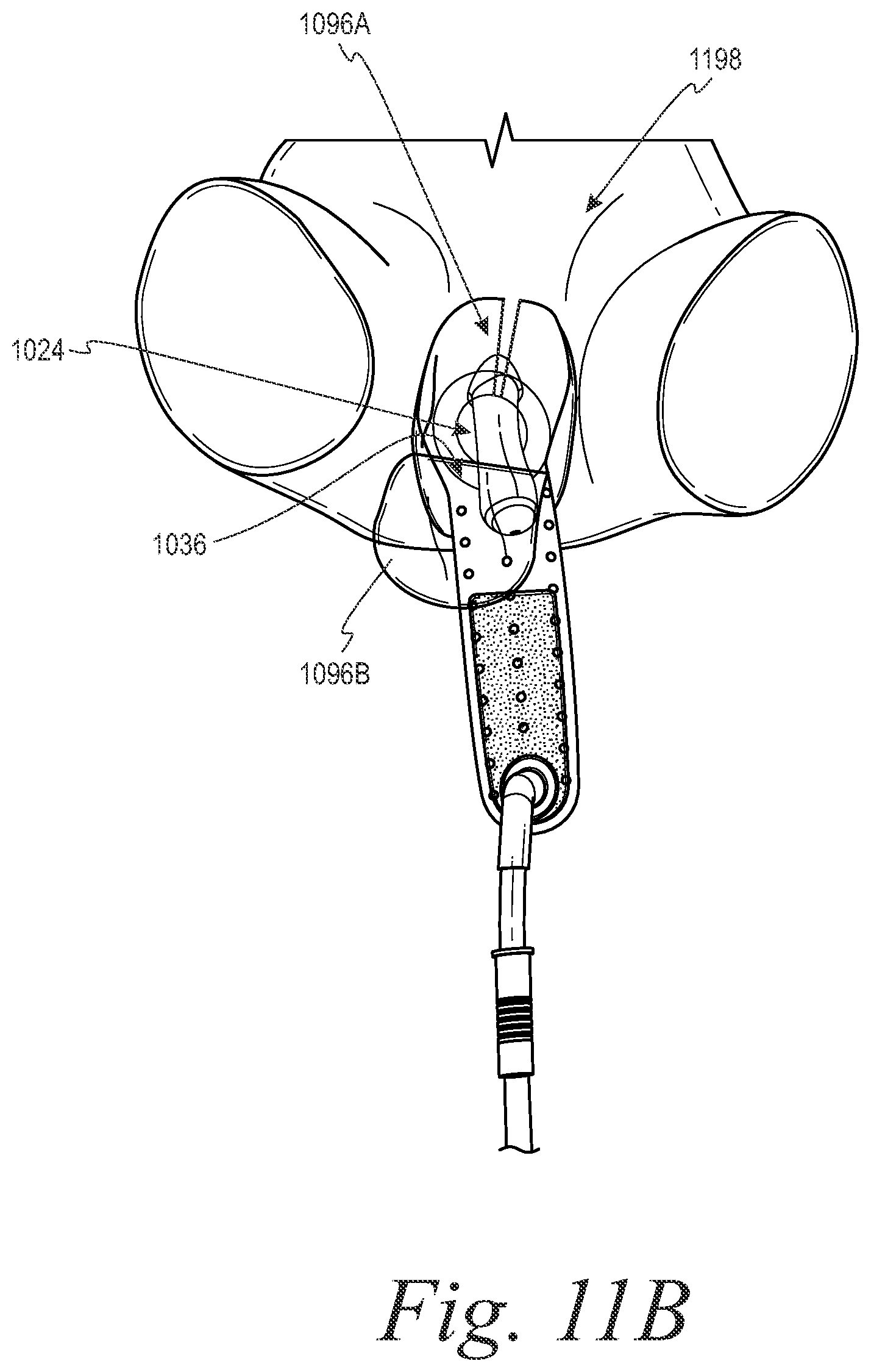 Patent US11779485 Figure 16 – Devices and systems for urine collection