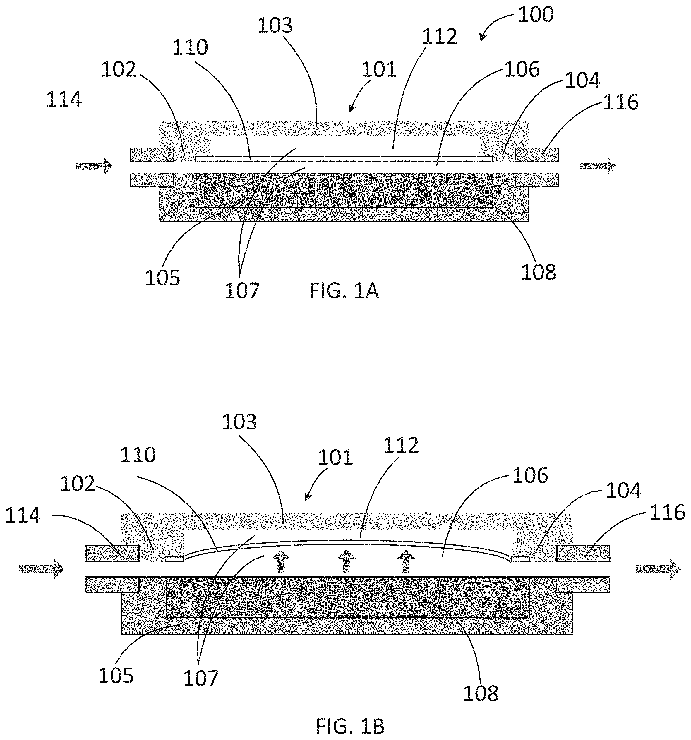 Patent US11779489 — Apparatus for treating excess intraocular fluid having an elastic membrane — Figure 1