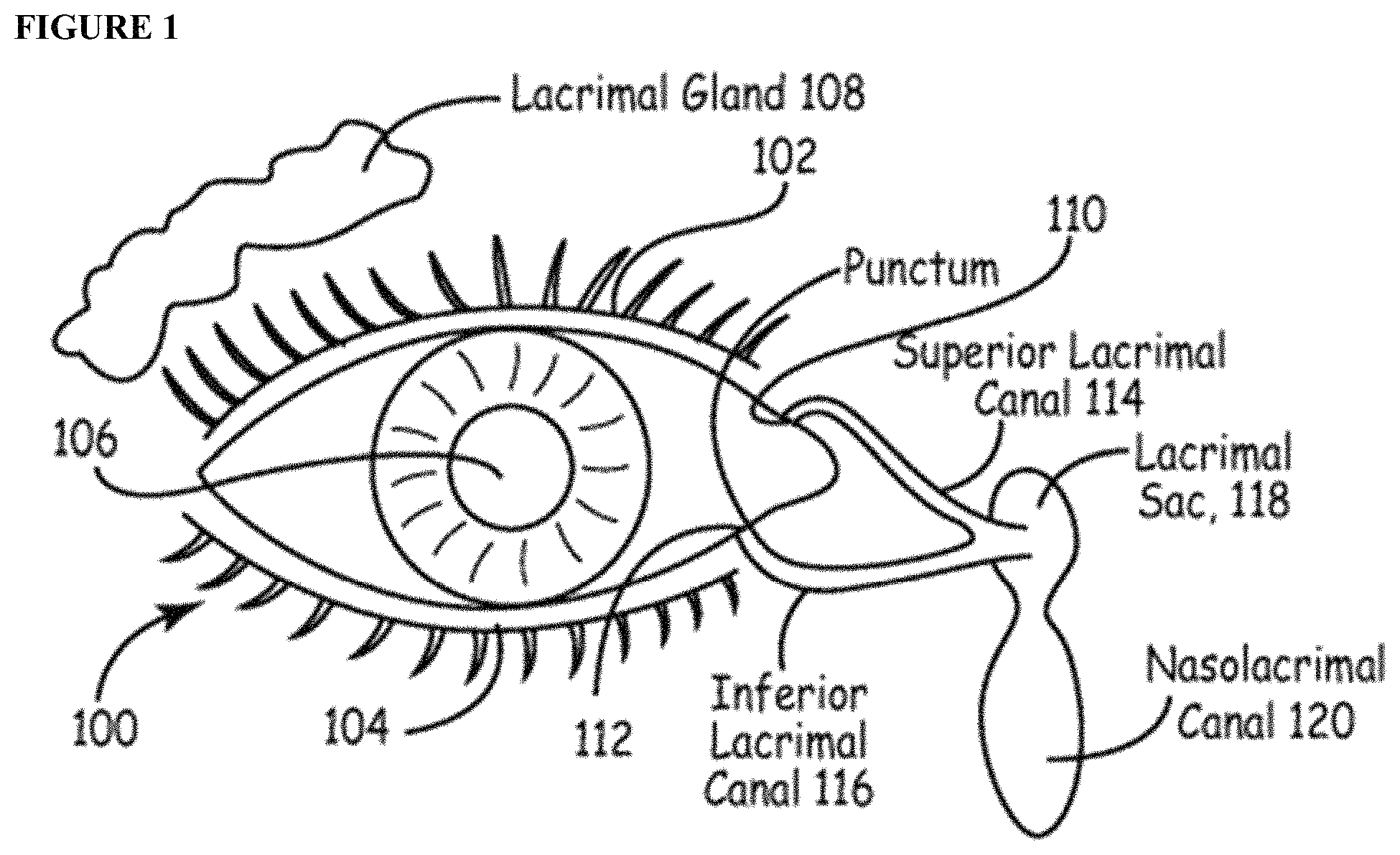 Patent US11779536 — Sustained release biodegradable intracanalicular inserts comprising a hydrogel and cyclosporine — Figure 1