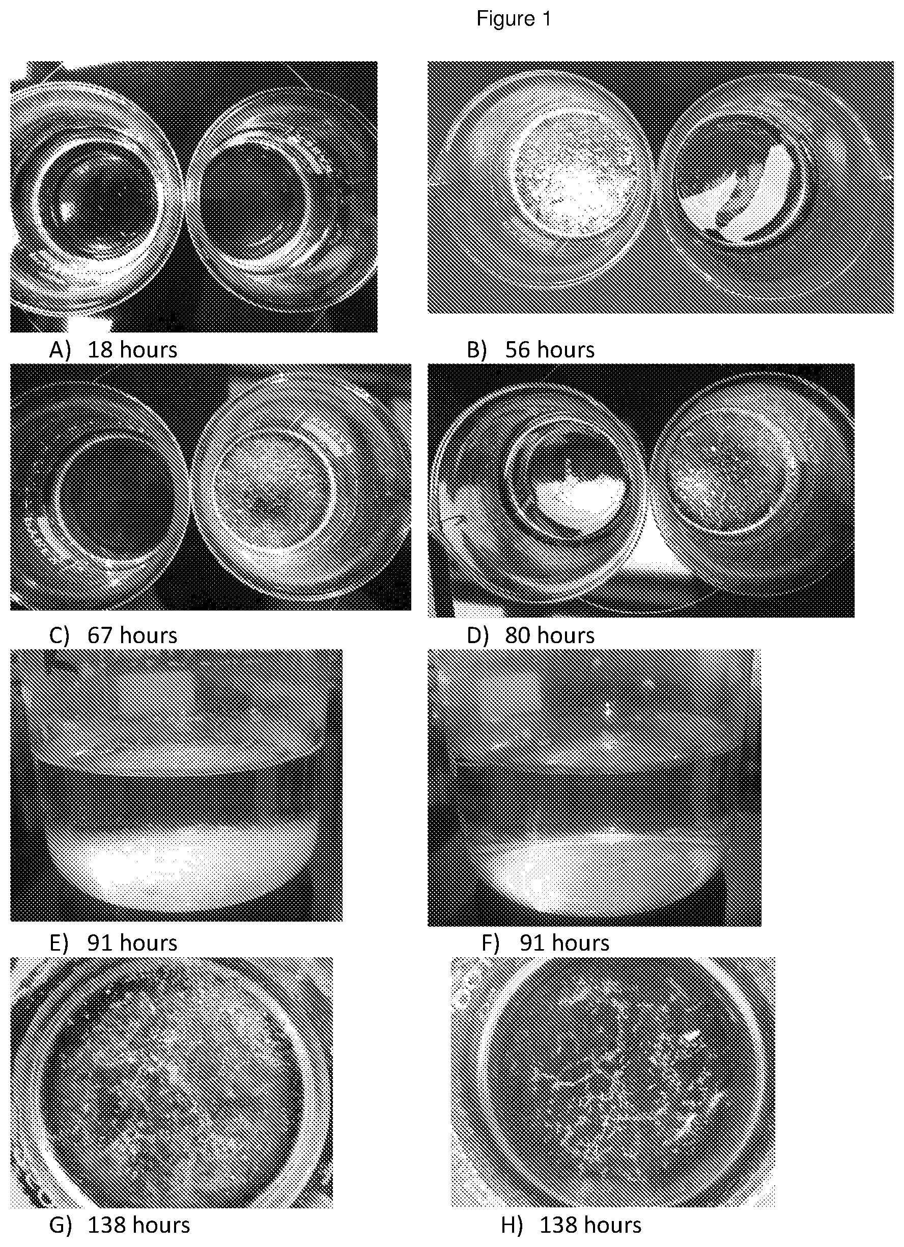 Patent US11779546 — Disassembly of cholesterol crystals — Figure 1
