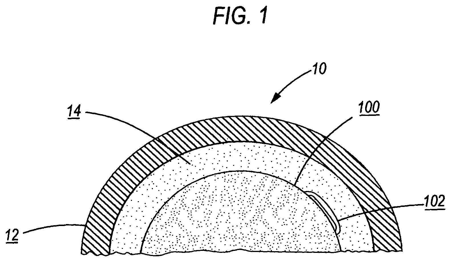 Patent US11779678 — Antimicrobial compression wrap — Figure 1