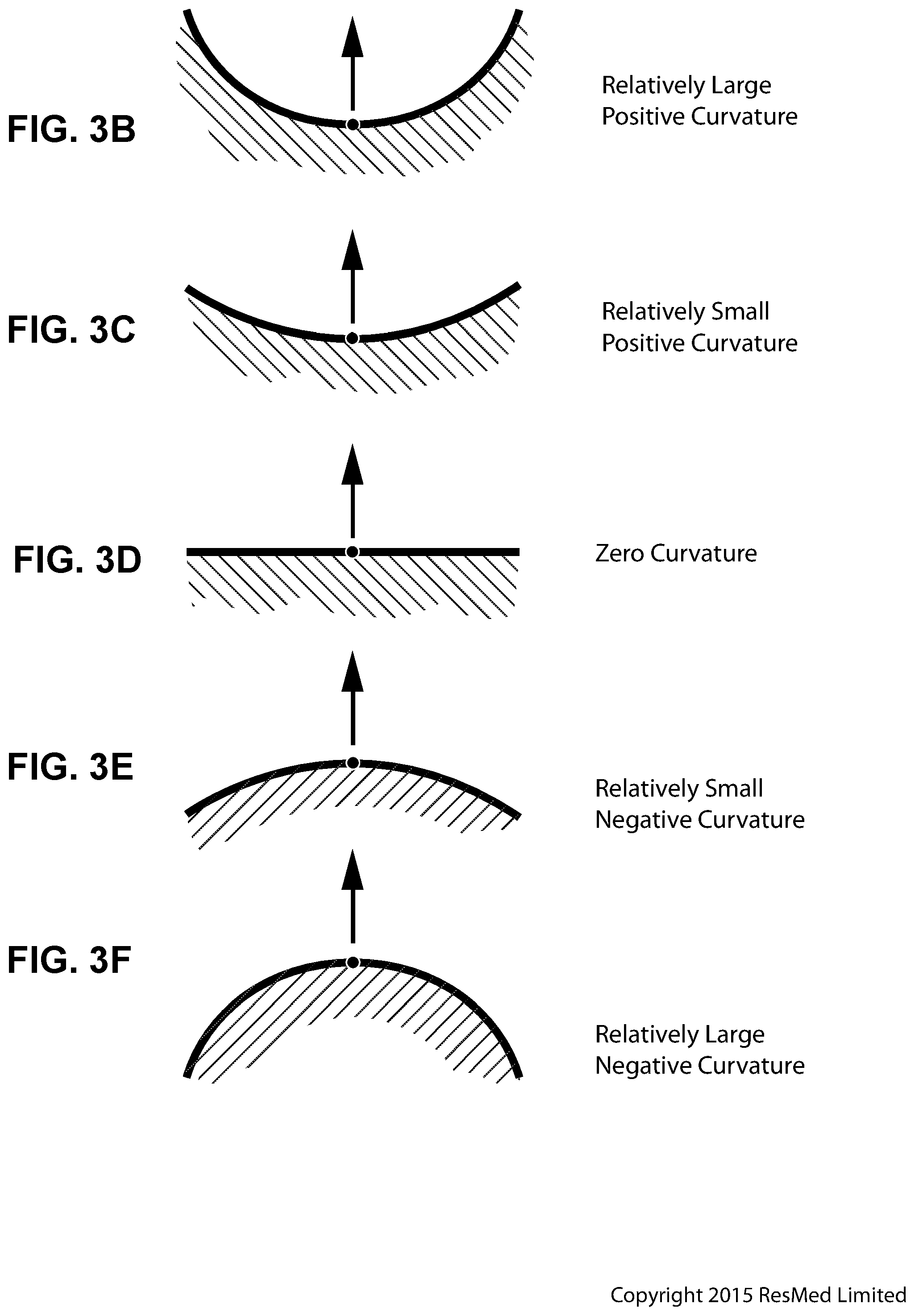 Patent US11779723 Figure 14 – Connector for positioning and stabilising structure