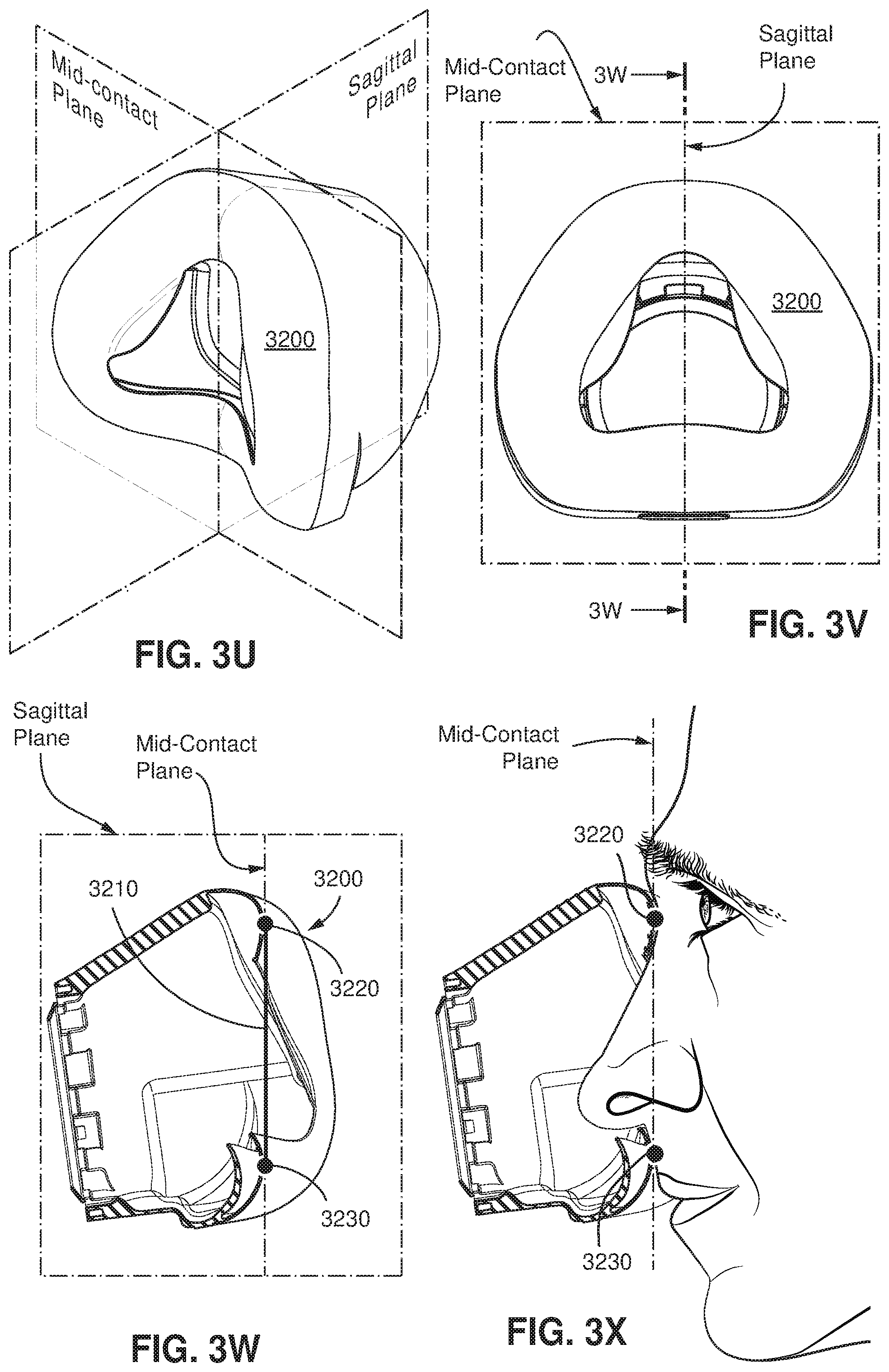 Patent US11779723 Figure 18 – Connector for positioning and stabilising structure