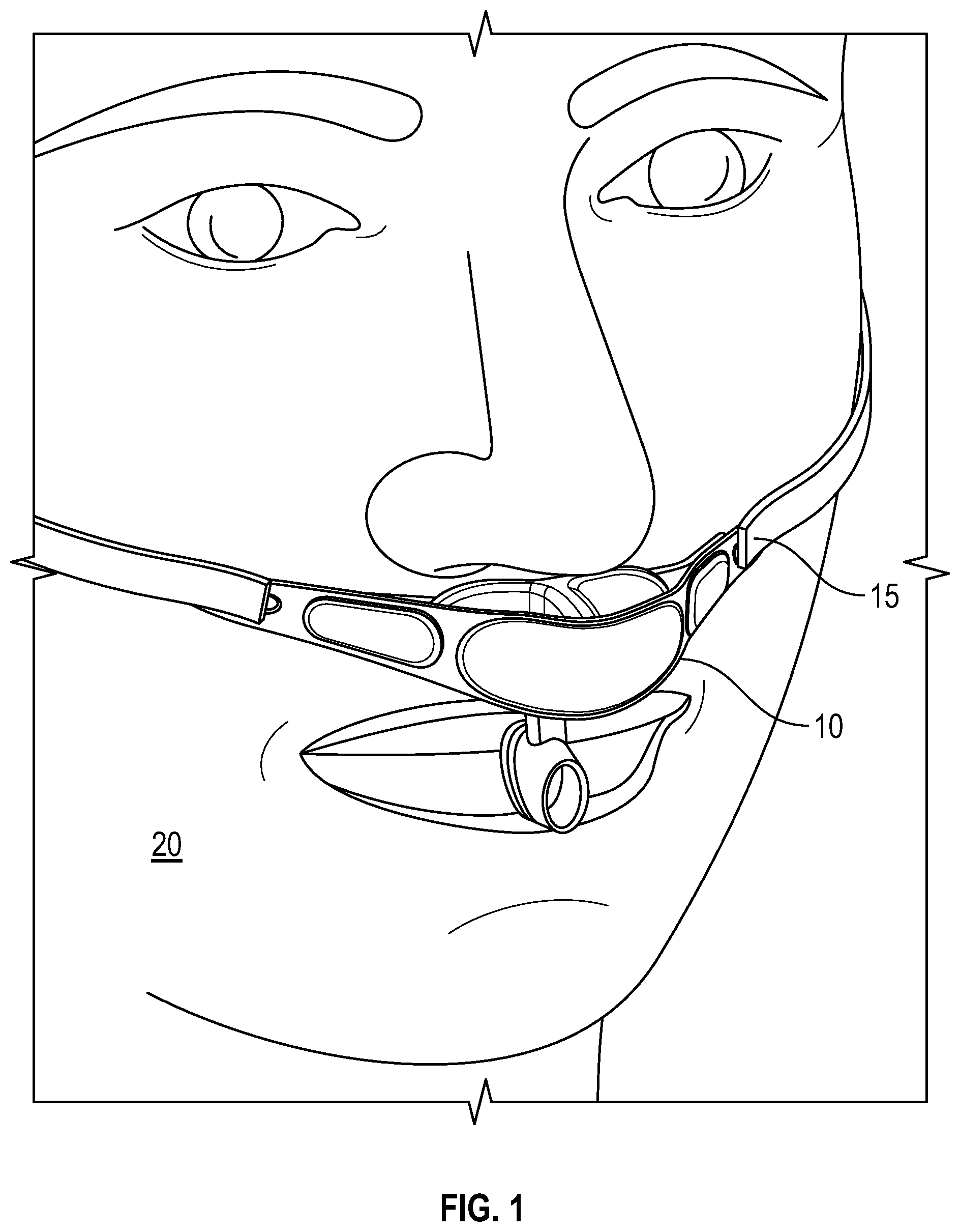 Patent US11779724 — Respiration sensor attachment device — Figure 1