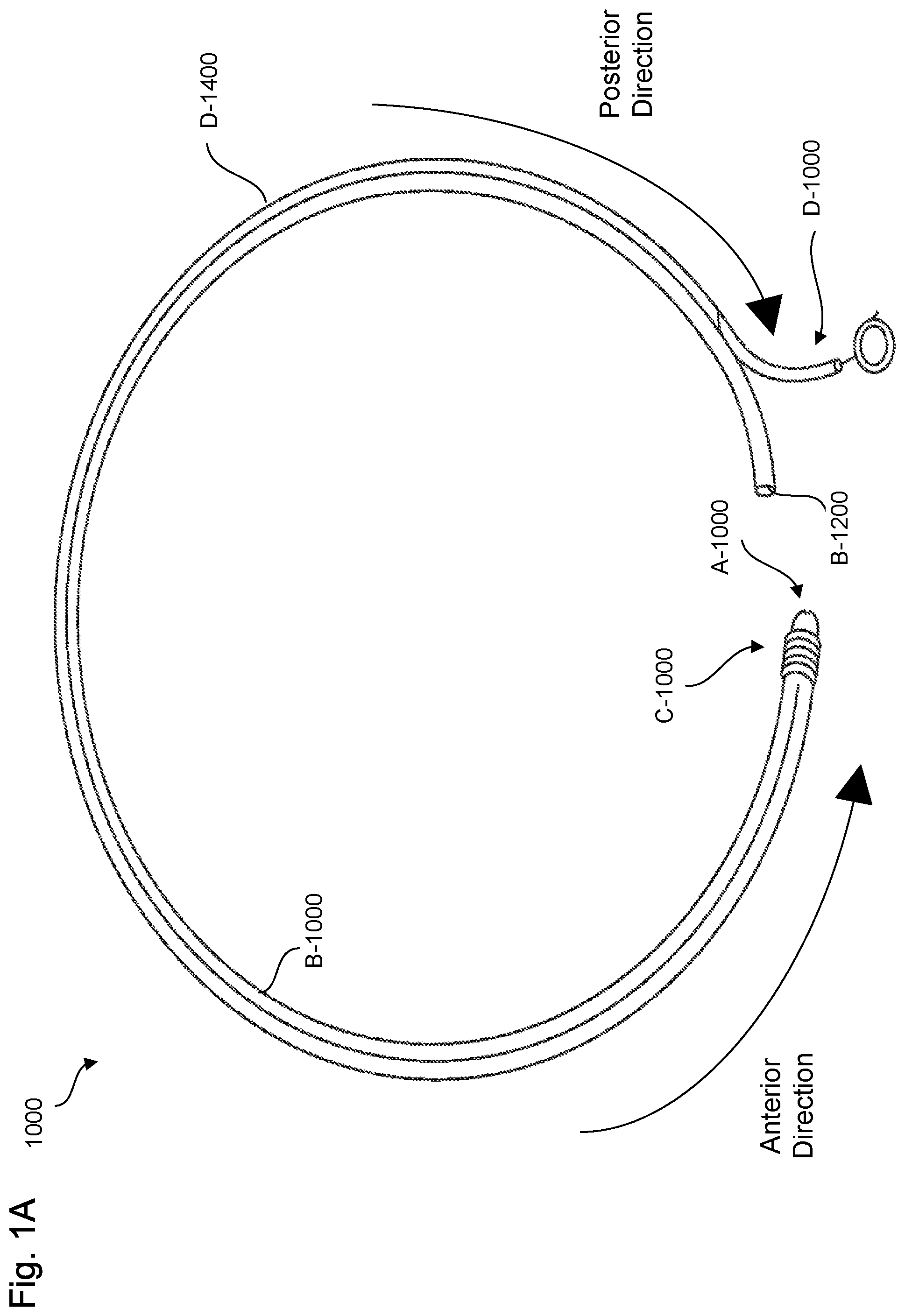 Patent US11779736 — Adjustable neck catheter — Figure 1