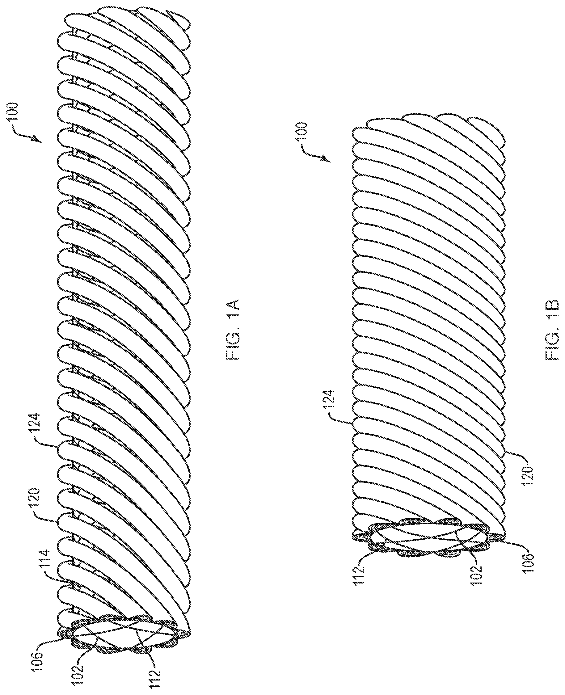Patent US11779738 Figure 1 – Extracellular matrix delivery device
