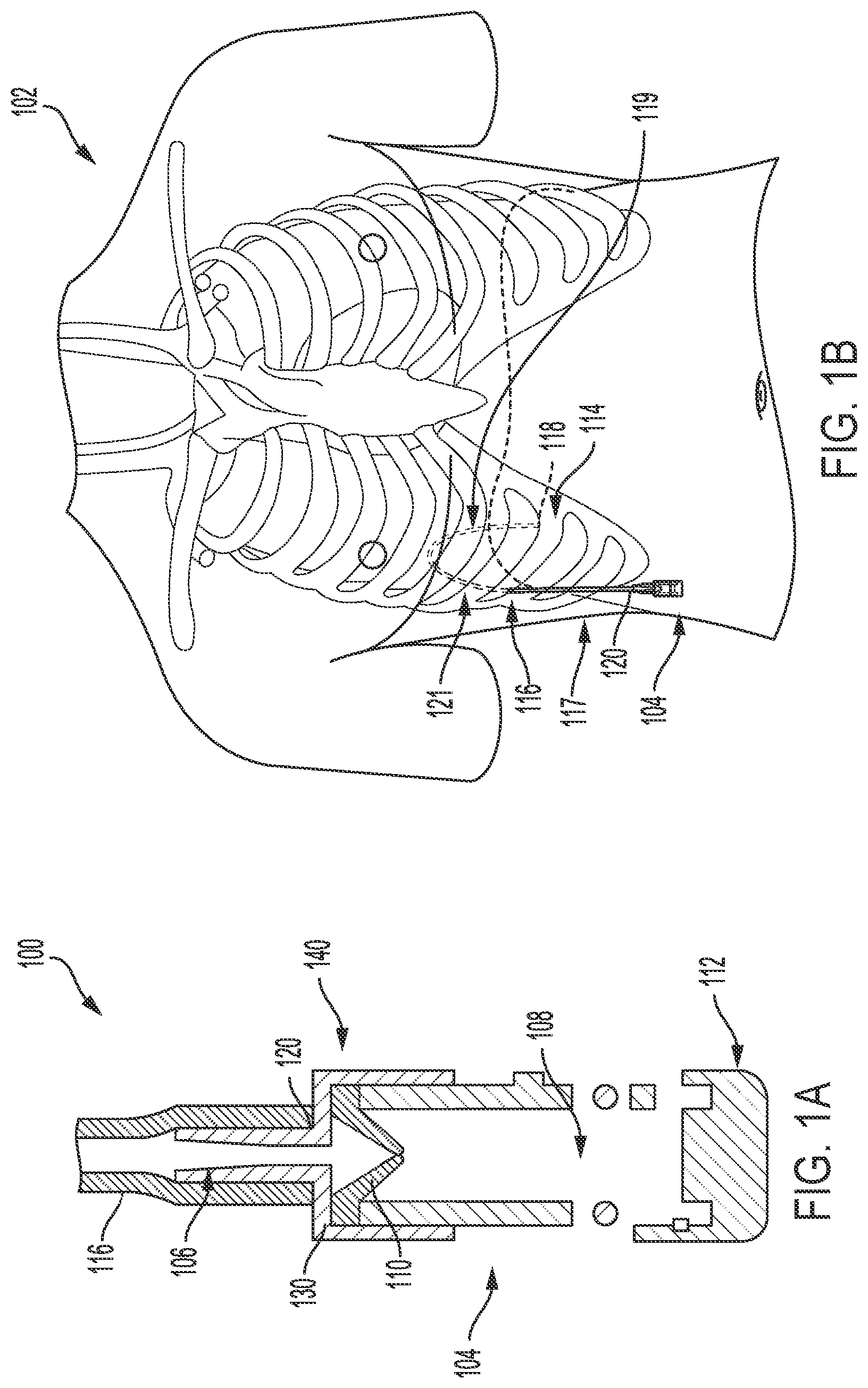 Patent US11779741 Figure 1 – Fluid-management system and method