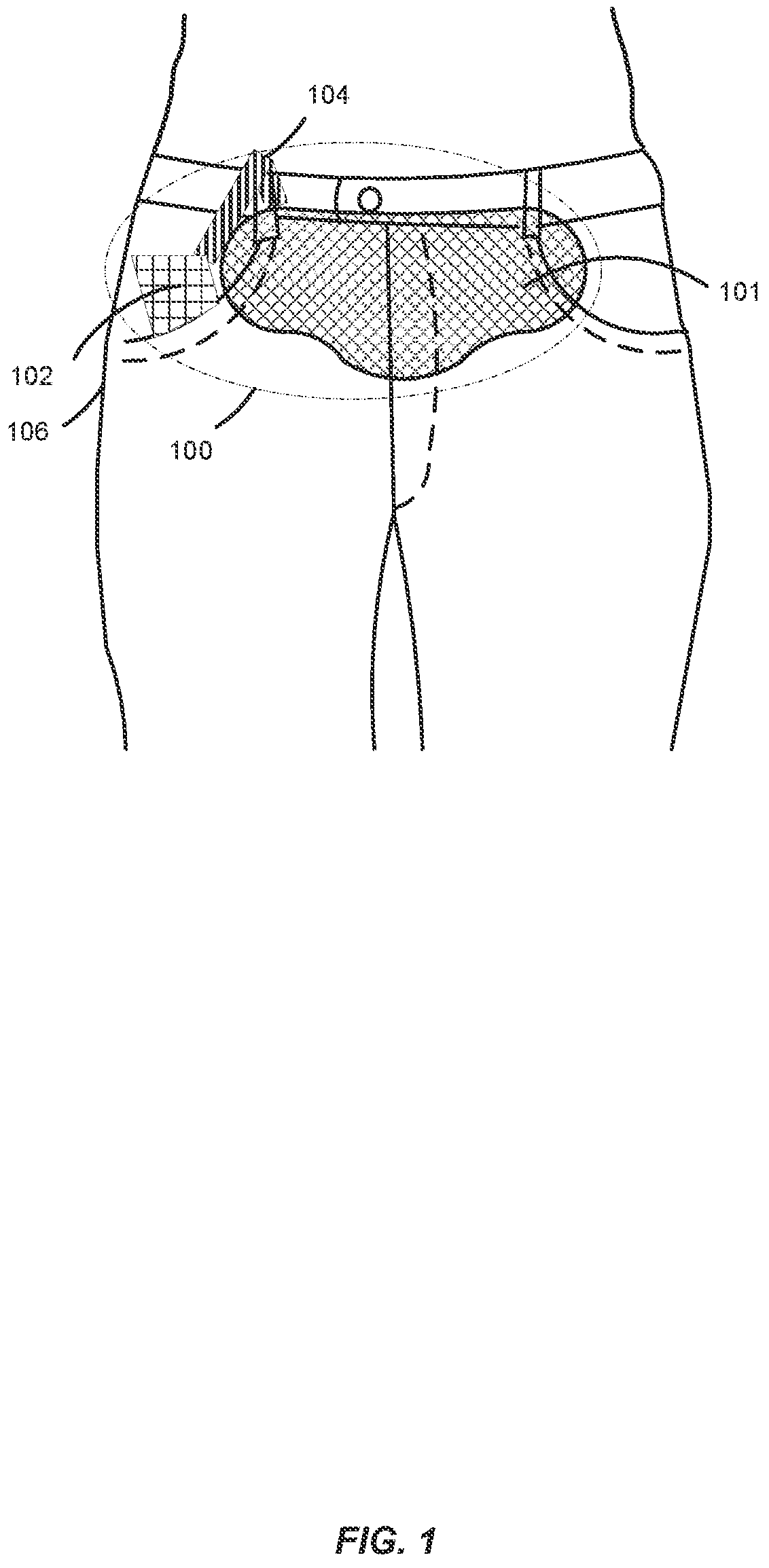 Patent US11779760 — Method and apparatus for portably treating muscular discomfort — Figure 1