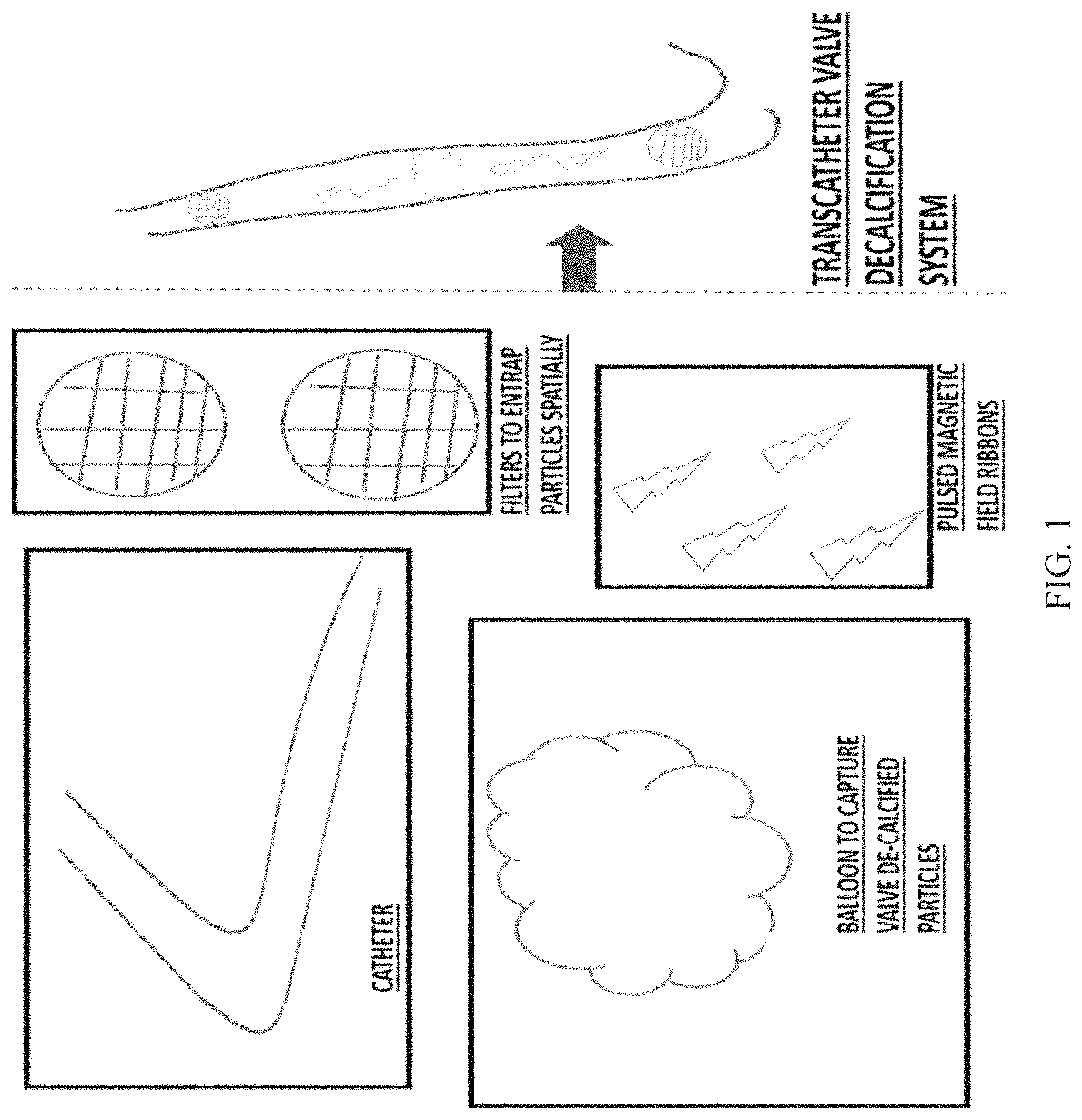 Patent US11779776 — Systems and methods for decalcifying cardiac valves and vessels — Figure 1