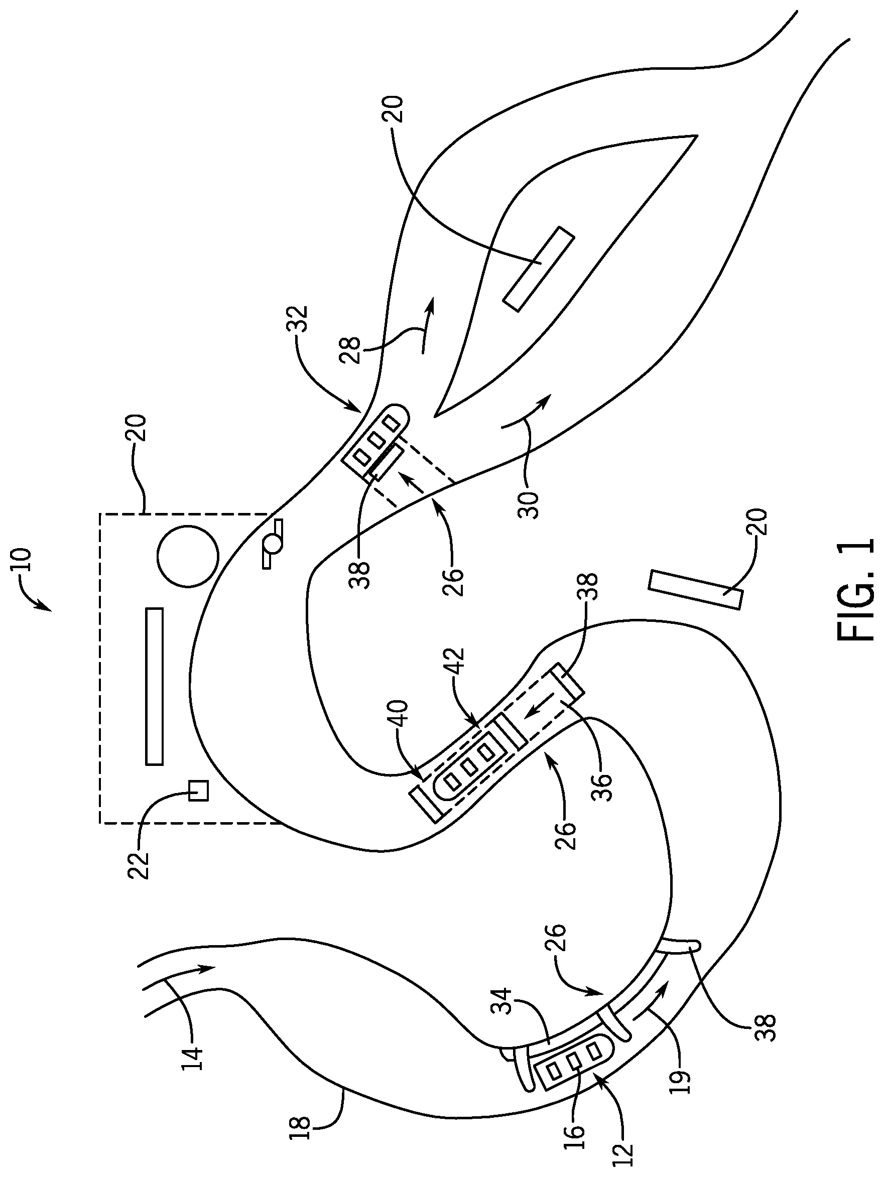 Patent US11779851 Figure 1 – Water amusement ride motion governor
