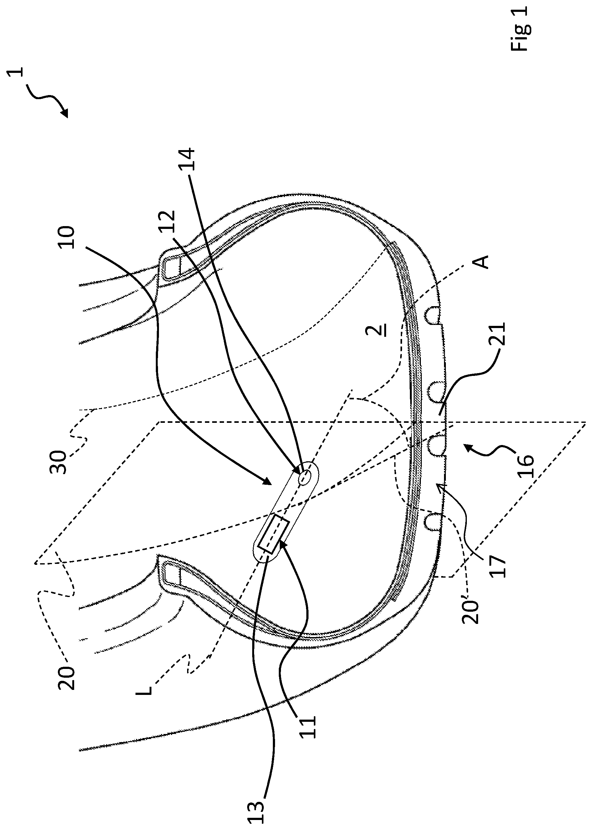 Patent US11780276 — Tyre comprising monitoring device with a flexible support — Figure 1