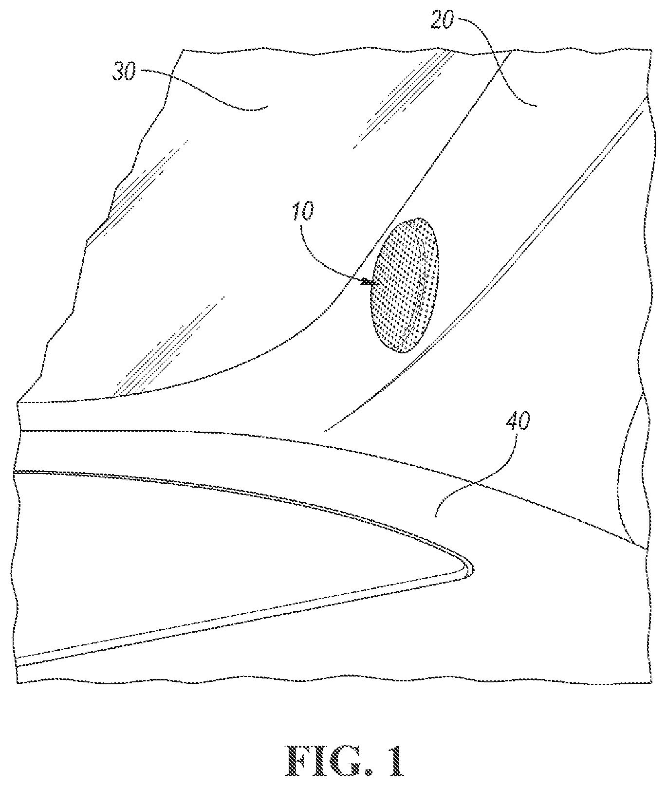 Patent US11780378 — Tweeter flush, surface, and starfish mount installation — Figure 1