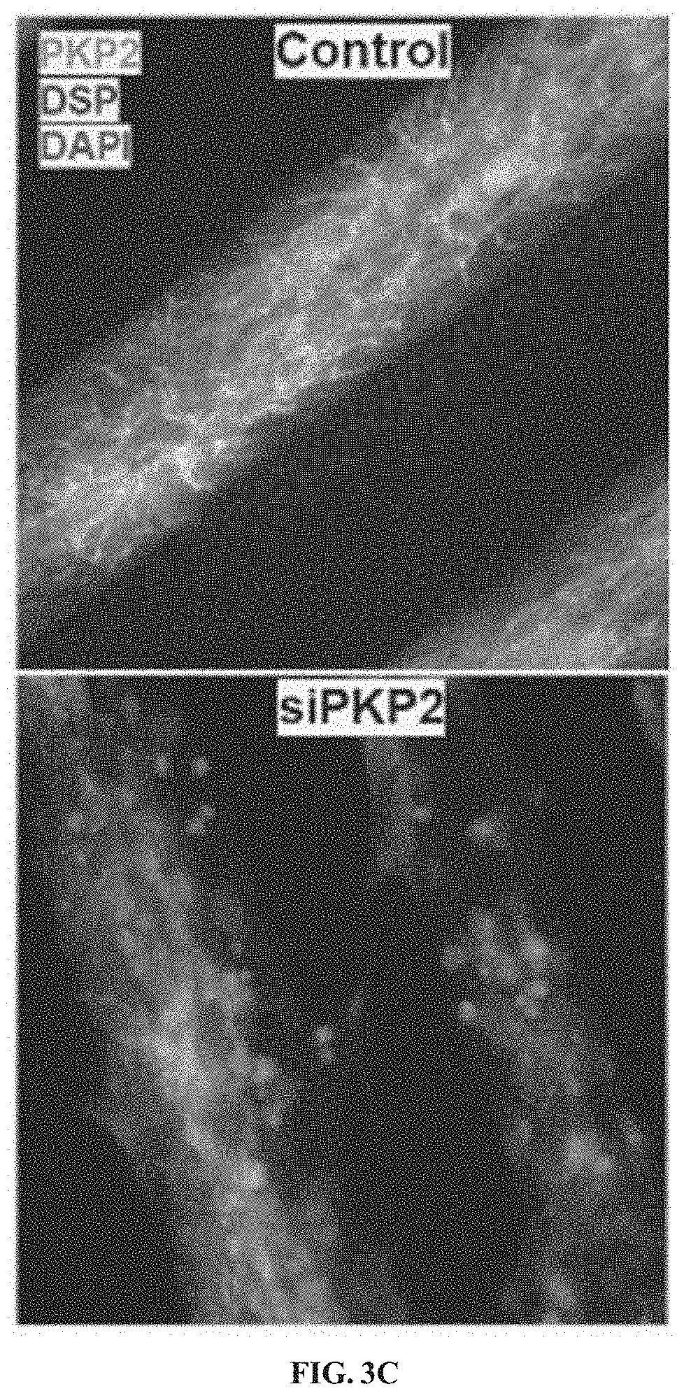 Patent US11781156 Figure 4 – Plakophillin-2 gene therapy methods and compositions