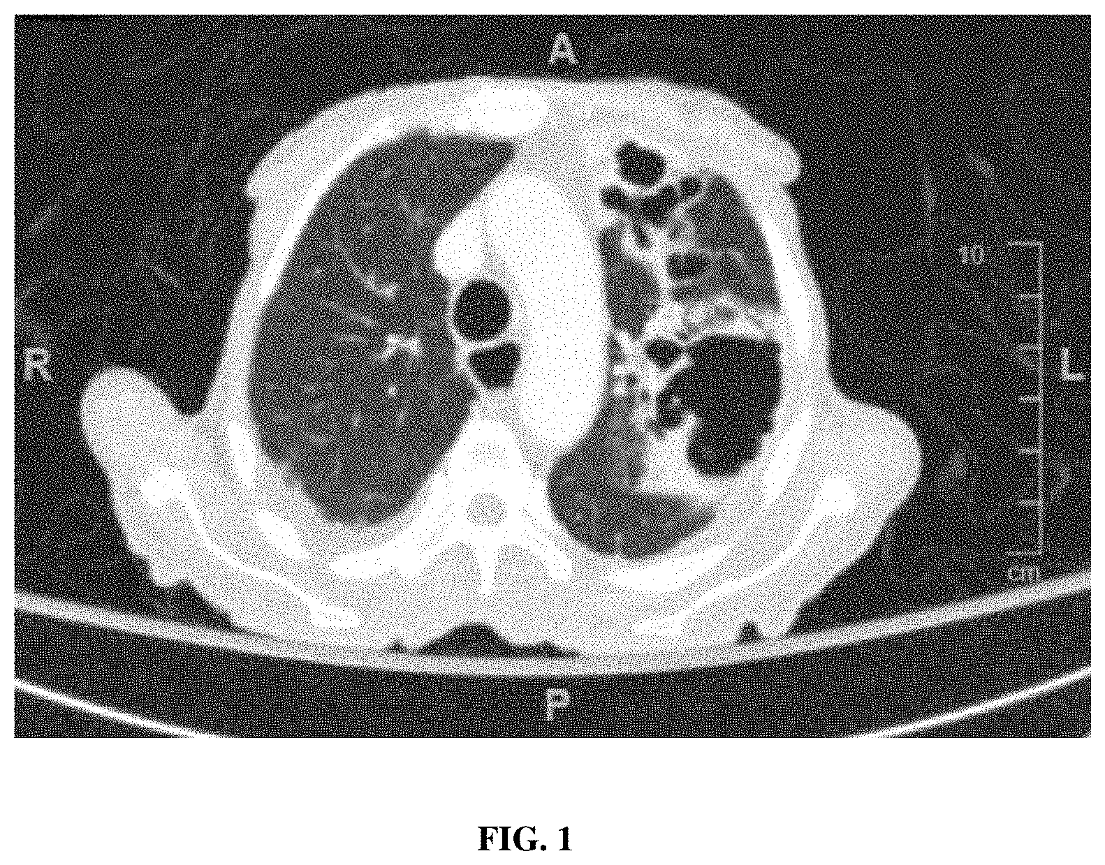 Patent US11781191 Figure 1 – Compositions and method for detecting Mycobacterium riyadhense