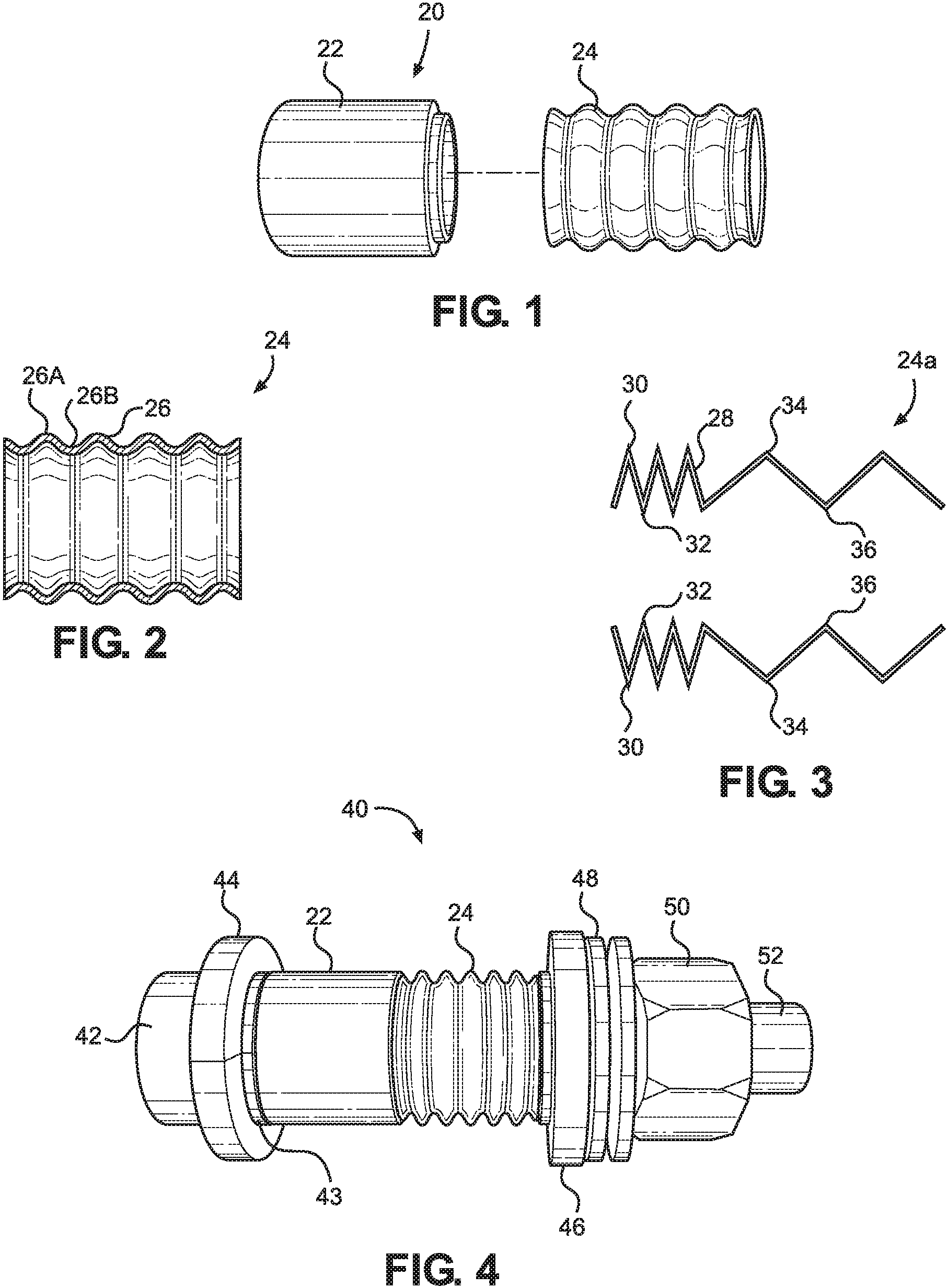 Patent US11781579 — Blind bolt with collapsible shear sleeve assembly — Figure 1