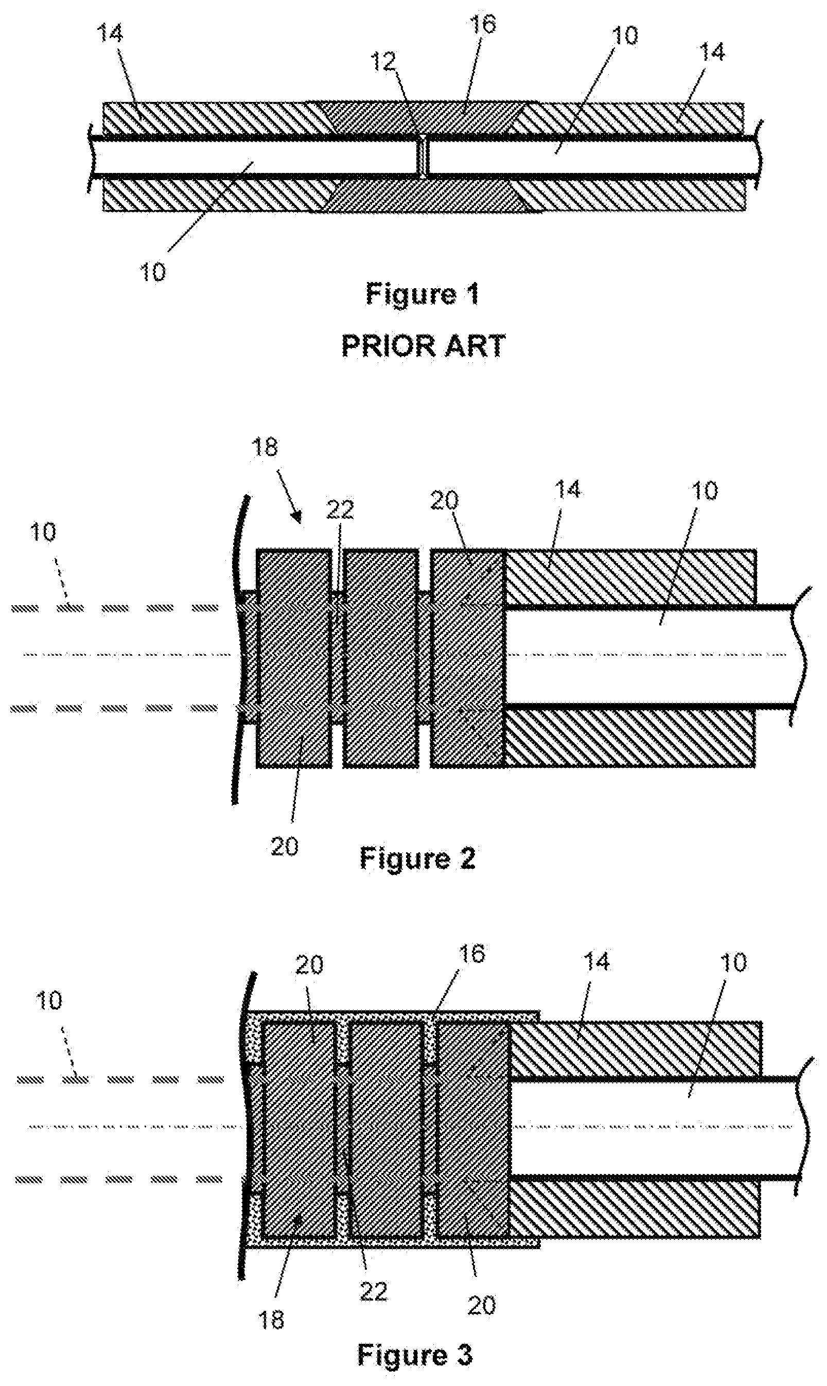 Patent US11781700 — Insulating inserts for field joints of coated rigid pipelines — Figure 1