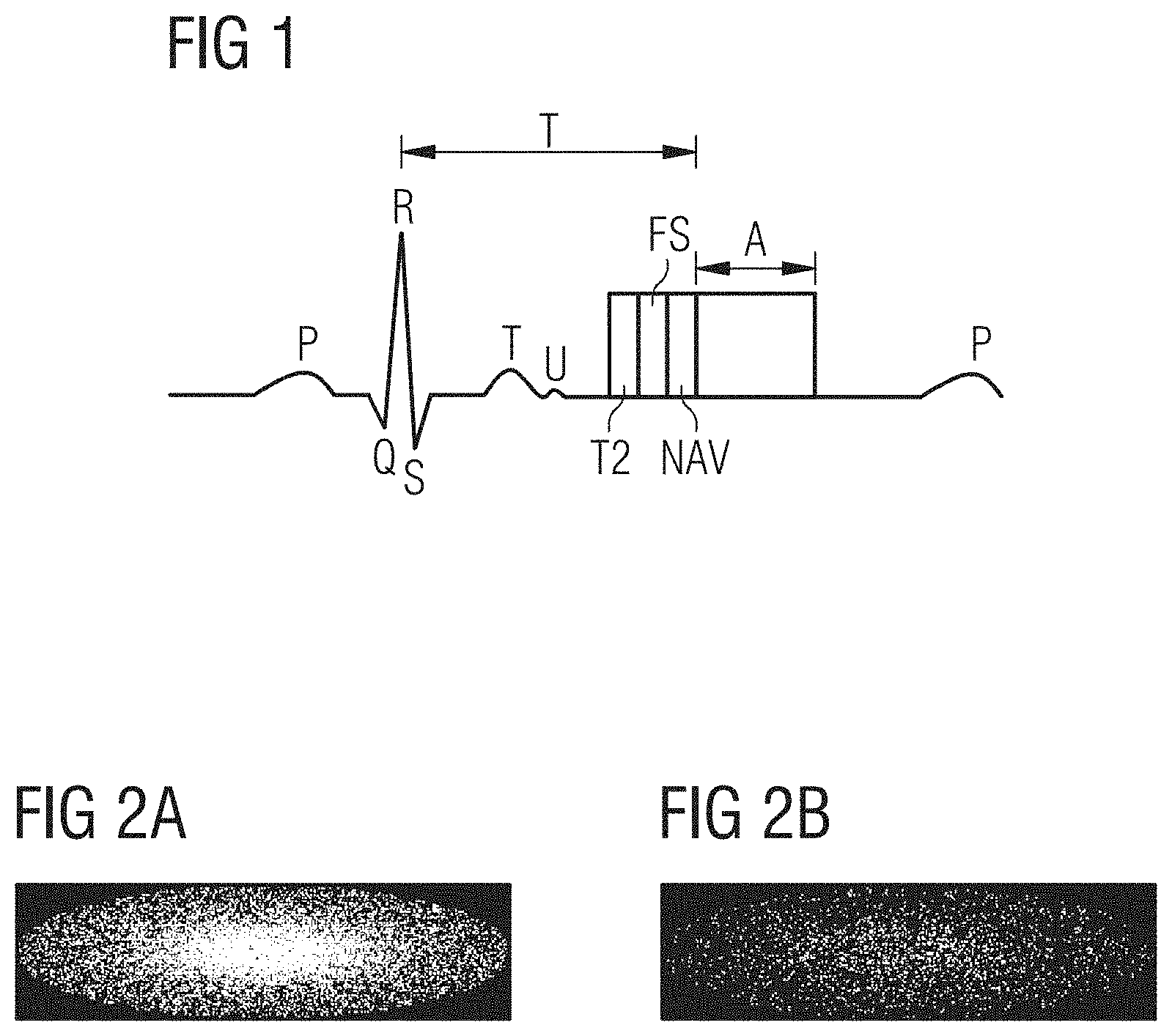 Patent US11782115 — Image reconstruction method — Figure 1