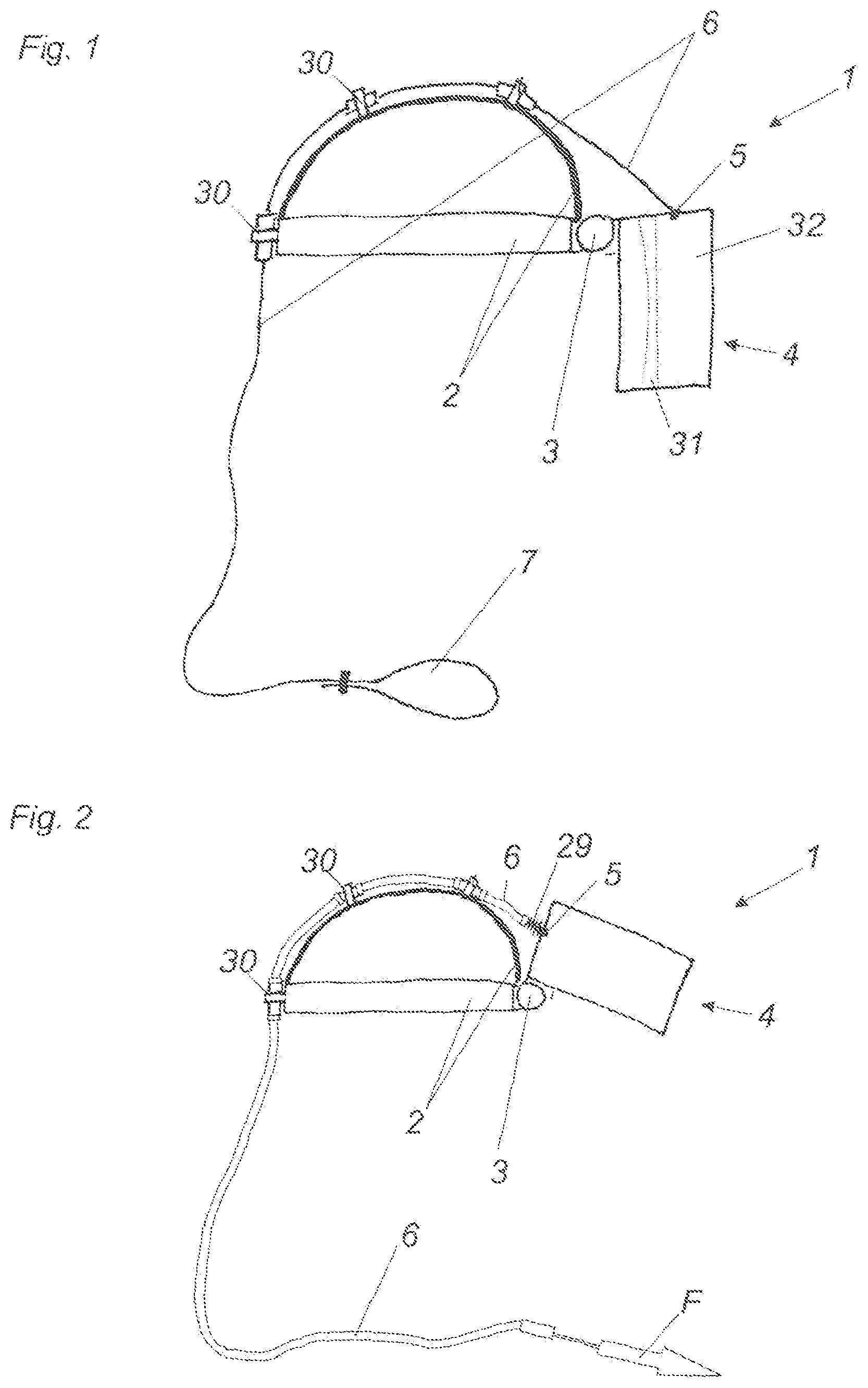 Patent US11782255 Figure 1 – Visualization device for transferring images of a microscopy device