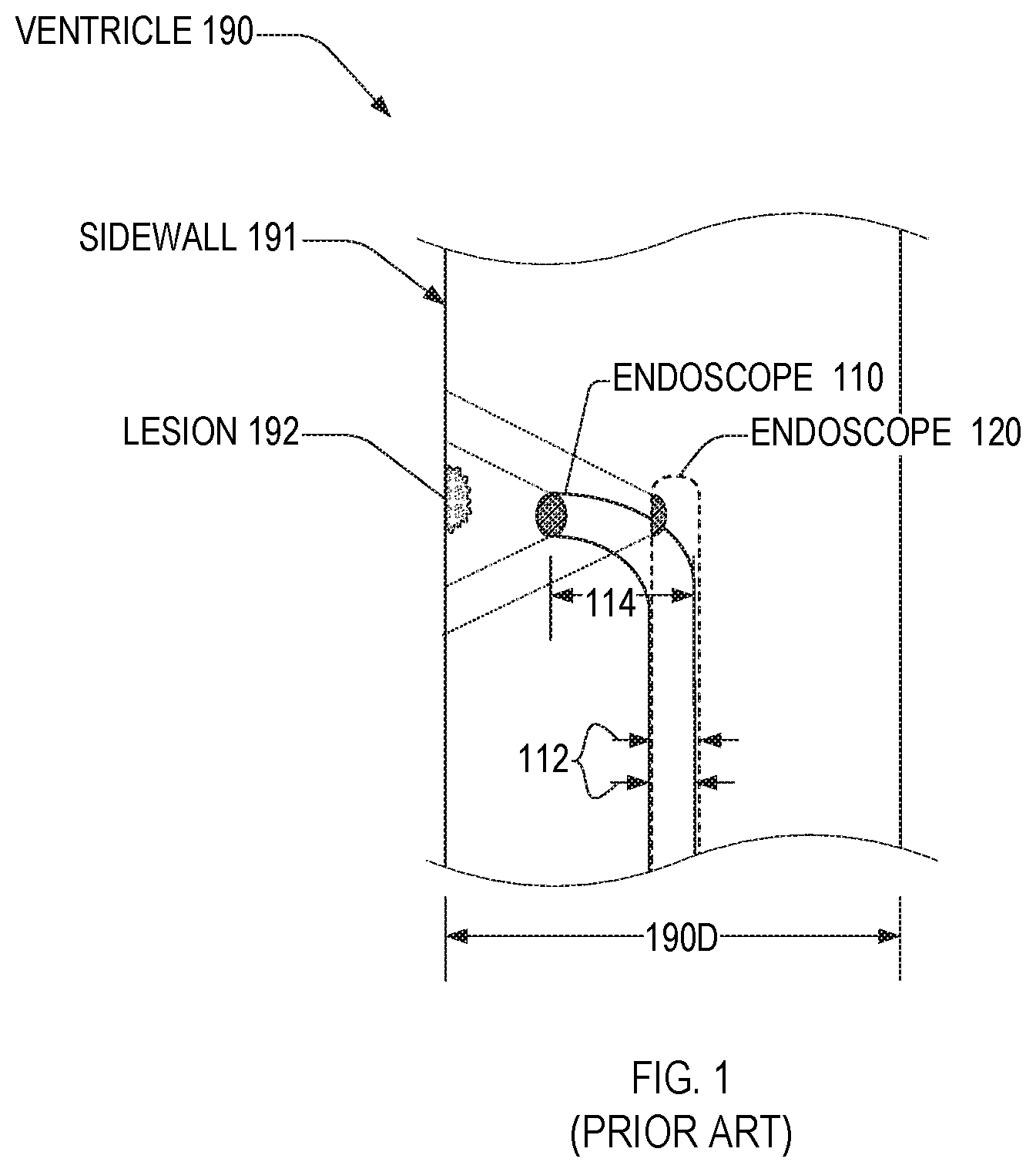 Patent US11782256 Figure 1 – Endoscope imager and associated method
