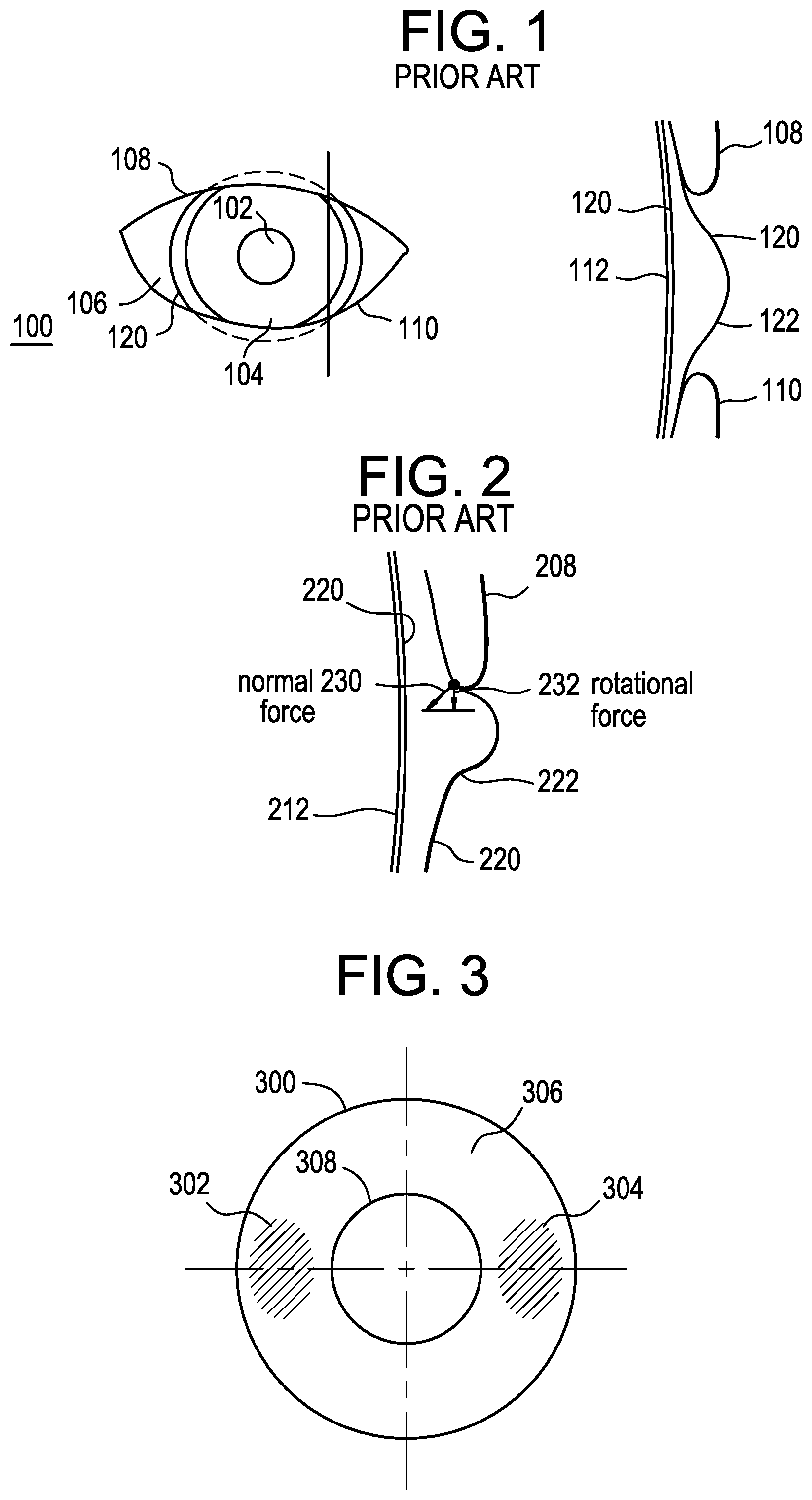 Patent US11782295 — Friction stabilized contact lenses — Figure 1