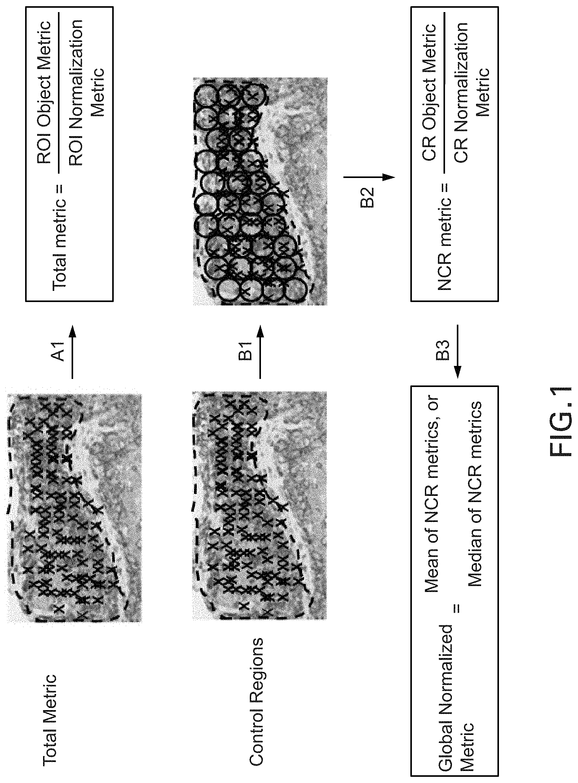 Patent US11783478 — Methods and systems for evaluation of immune cell infiltrate in tumor samples — Figure 1