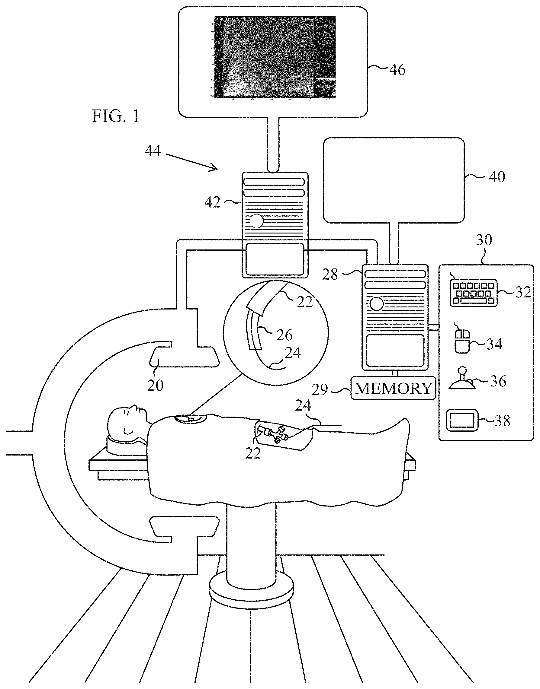 Patent US11783607 — Automatic image feature removal — Figure 1