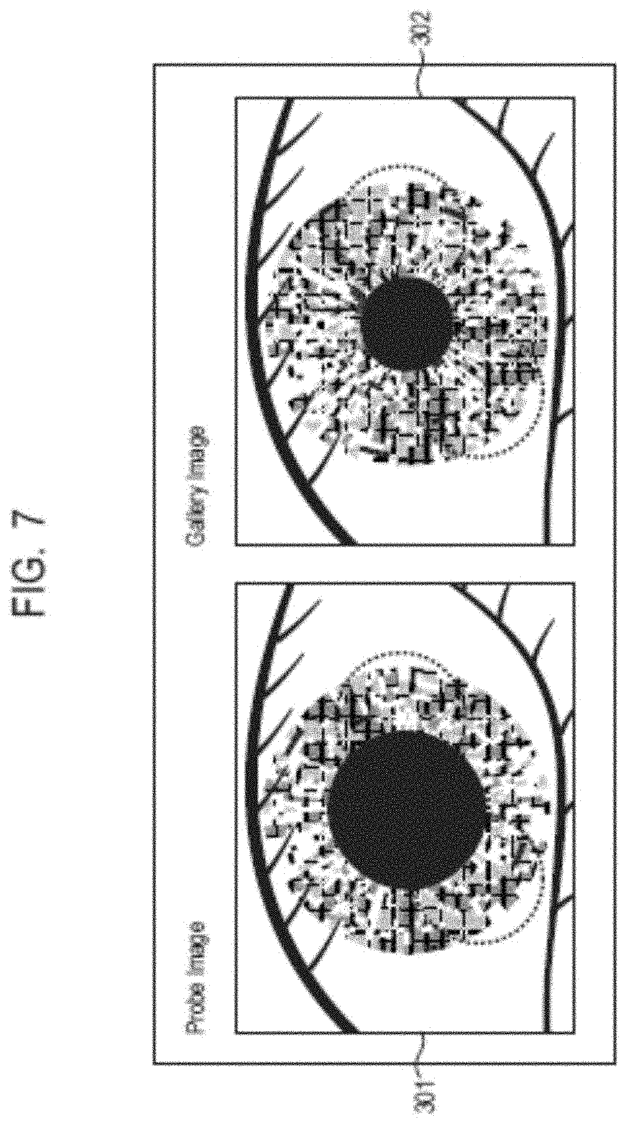 Patent US11783631 Figure 7 – Information processing system, information processing method, and storage medium