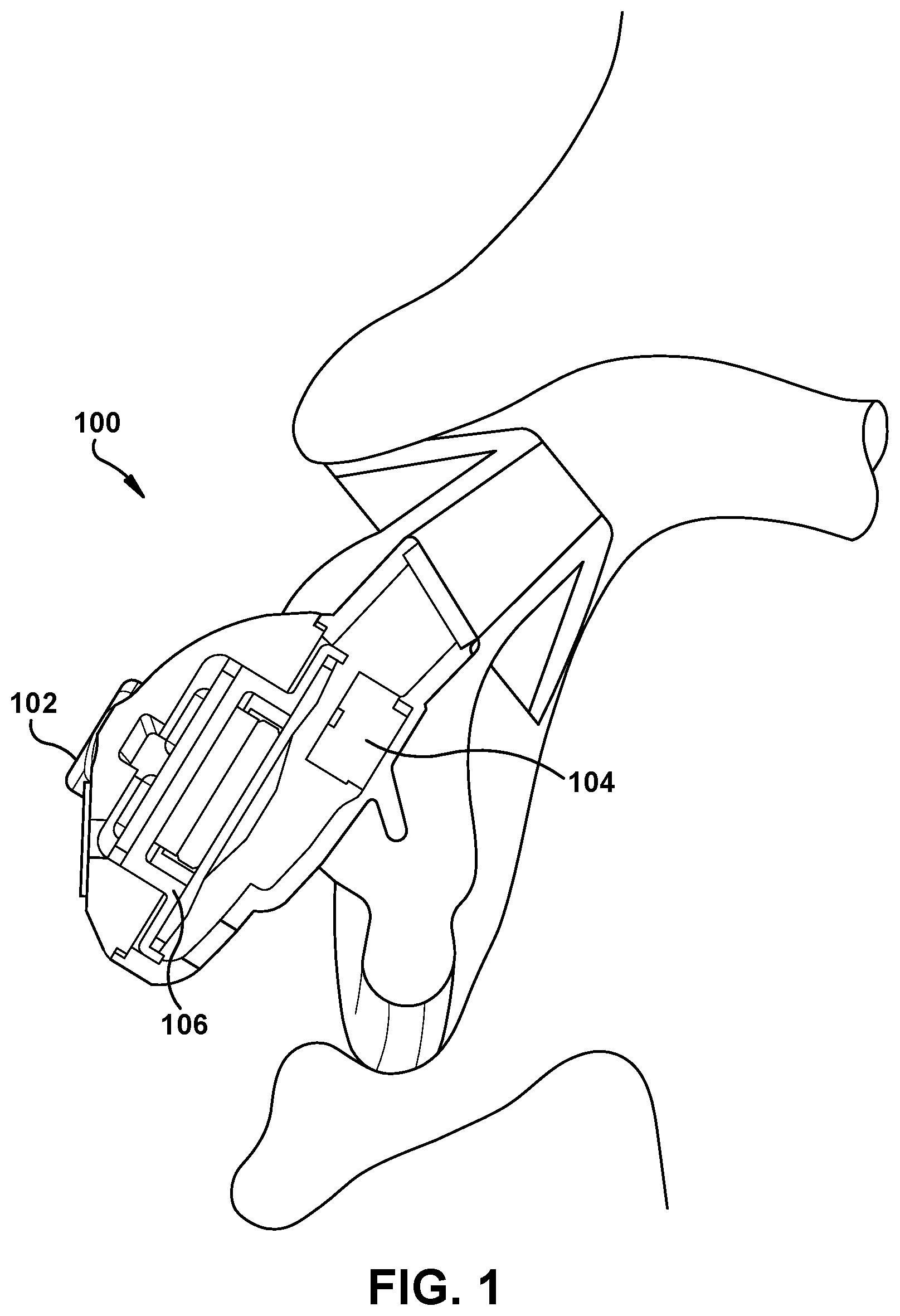 Patent US11785382 Figure 1 – Gain-adaptive active noise reduction (ANR) device