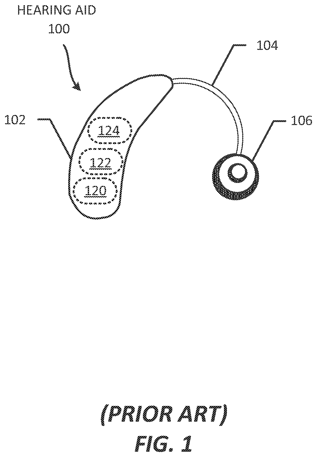 Patent US11785399 — Hearable device comprising integrated device and wireless functionality — Figure 1