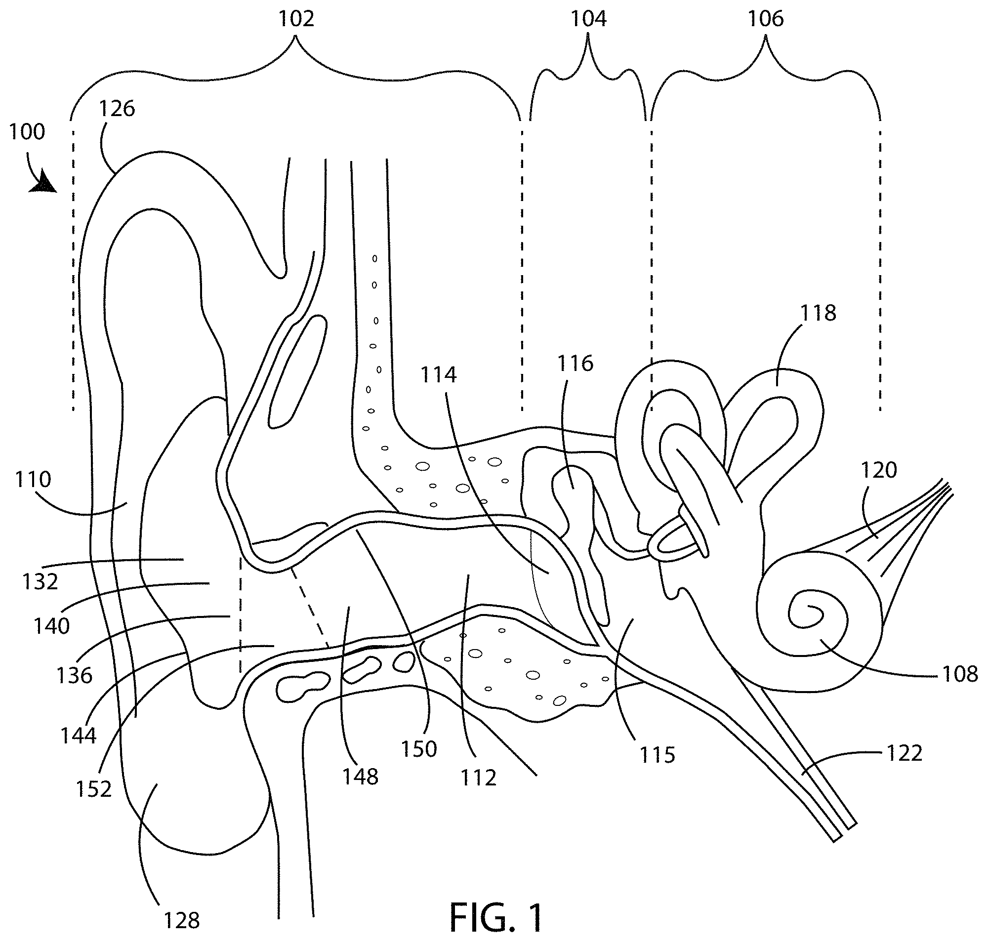 Patent US11785403 — Device to optically verify custom hearing aid fit and method of use — Figure 1