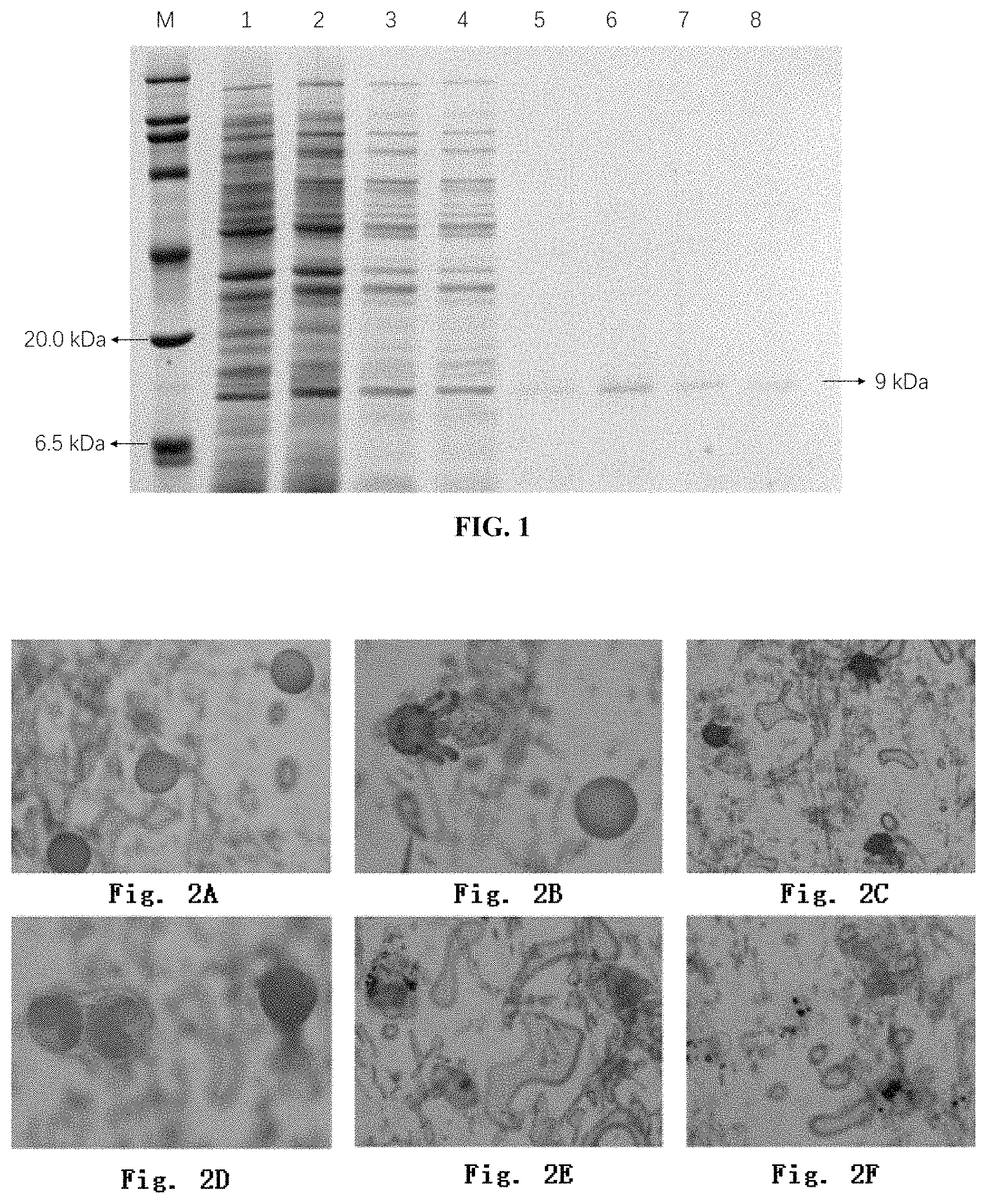 Patent US11793204 — BVP8 protein for killing Tetranychid mites and use thereof — Figure 1