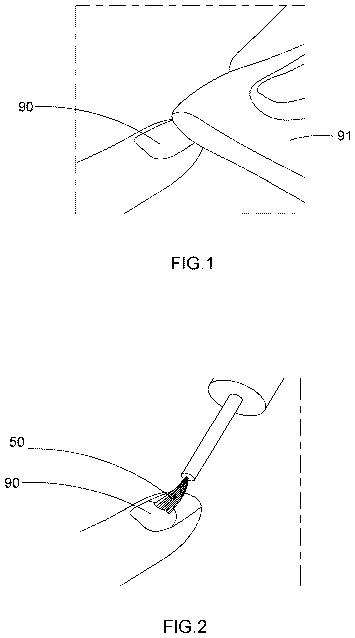 Patent US11793289 — Artificial nail tip and curing composition set and applying method thereof — Figure 1