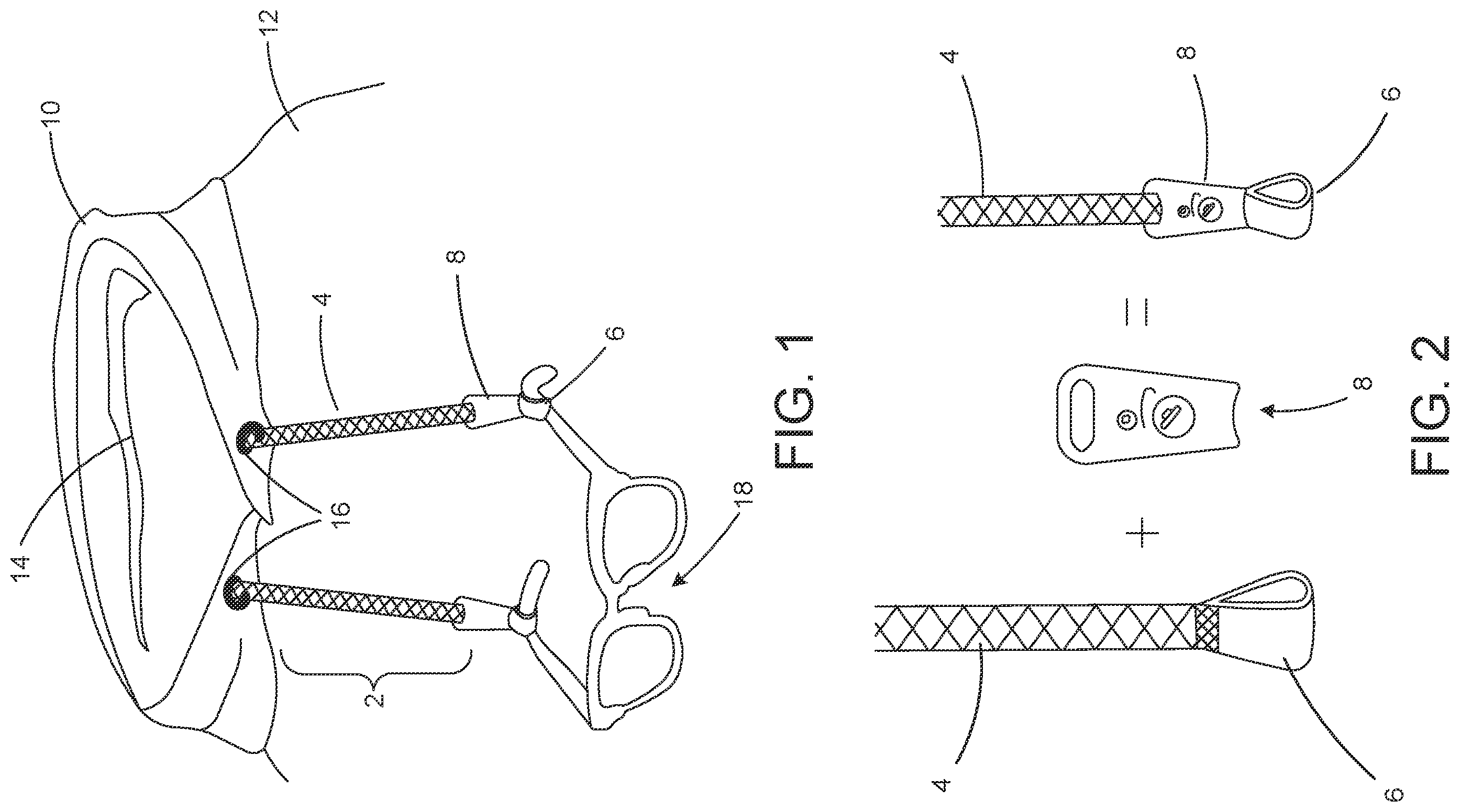 Patent US11793297 — Sensory-friendly eyewear holder — Figure 1