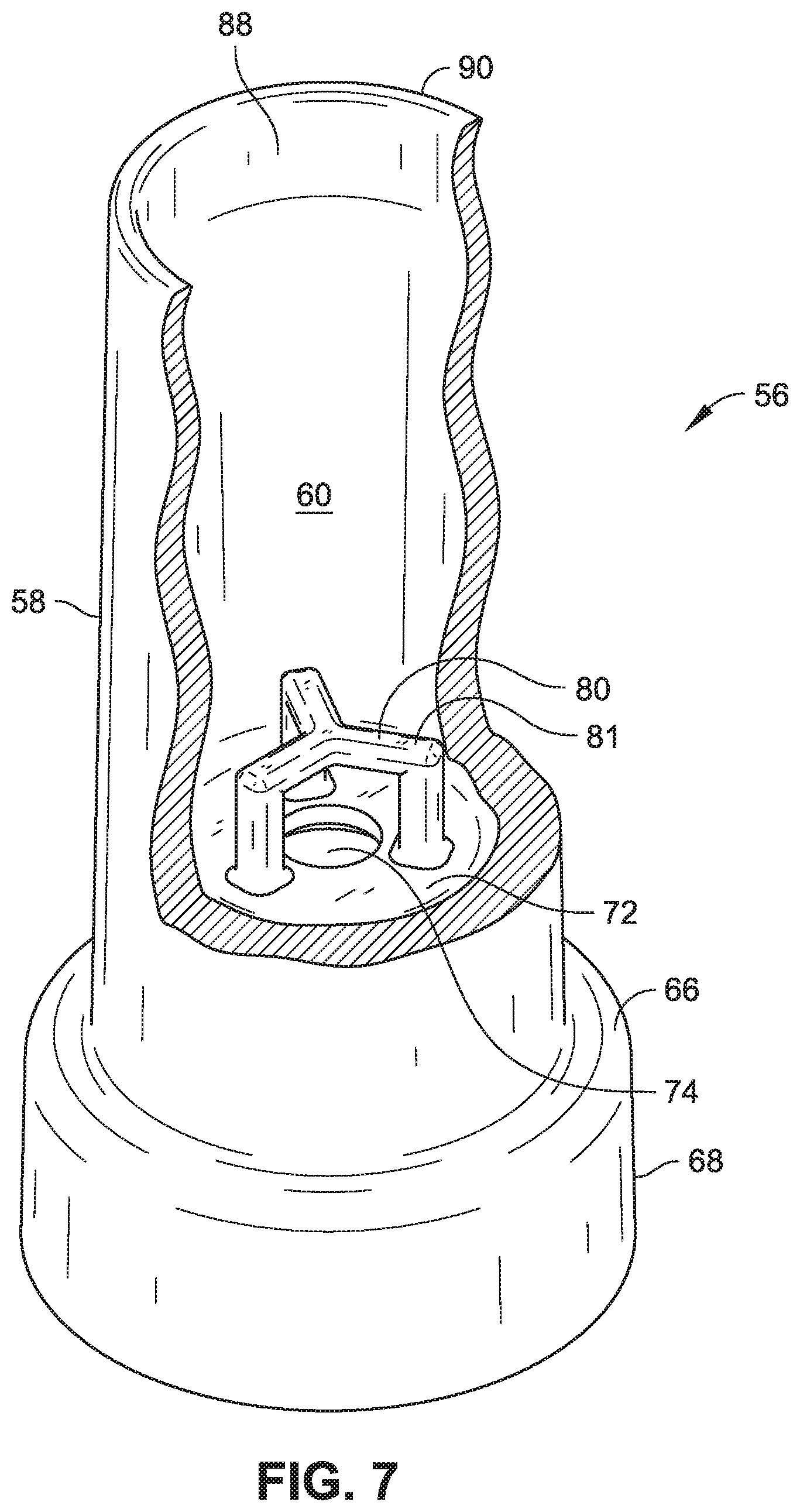 Patent US11793358 Figure 5 – Formulation and dispenser systems for beverage foam toppings