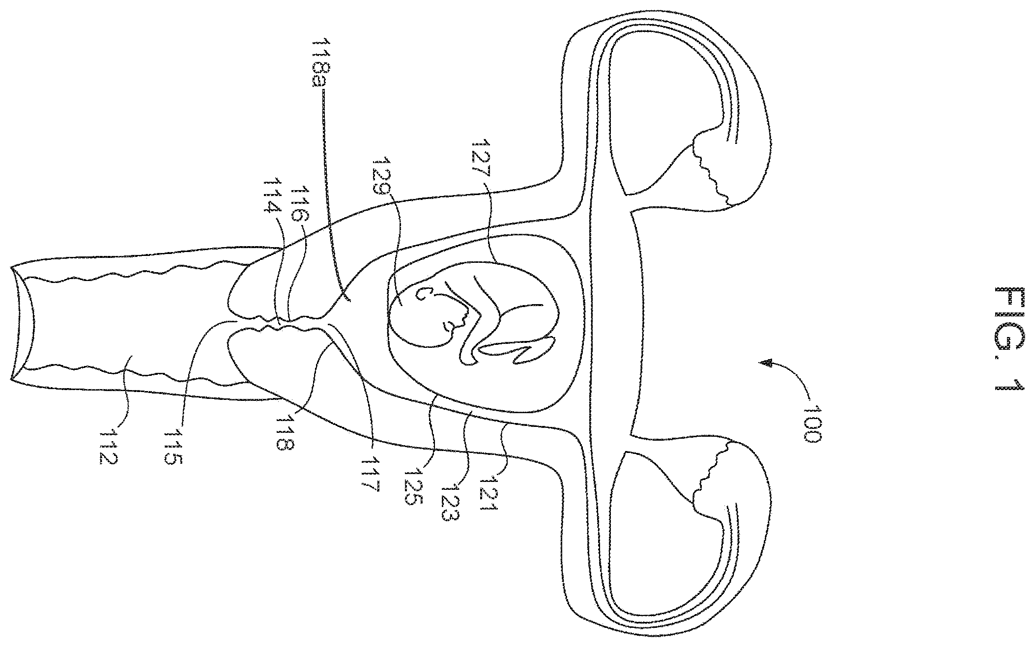 Patent US11793416 Figure 1 – System and method for child-bearing monitoring and assistance