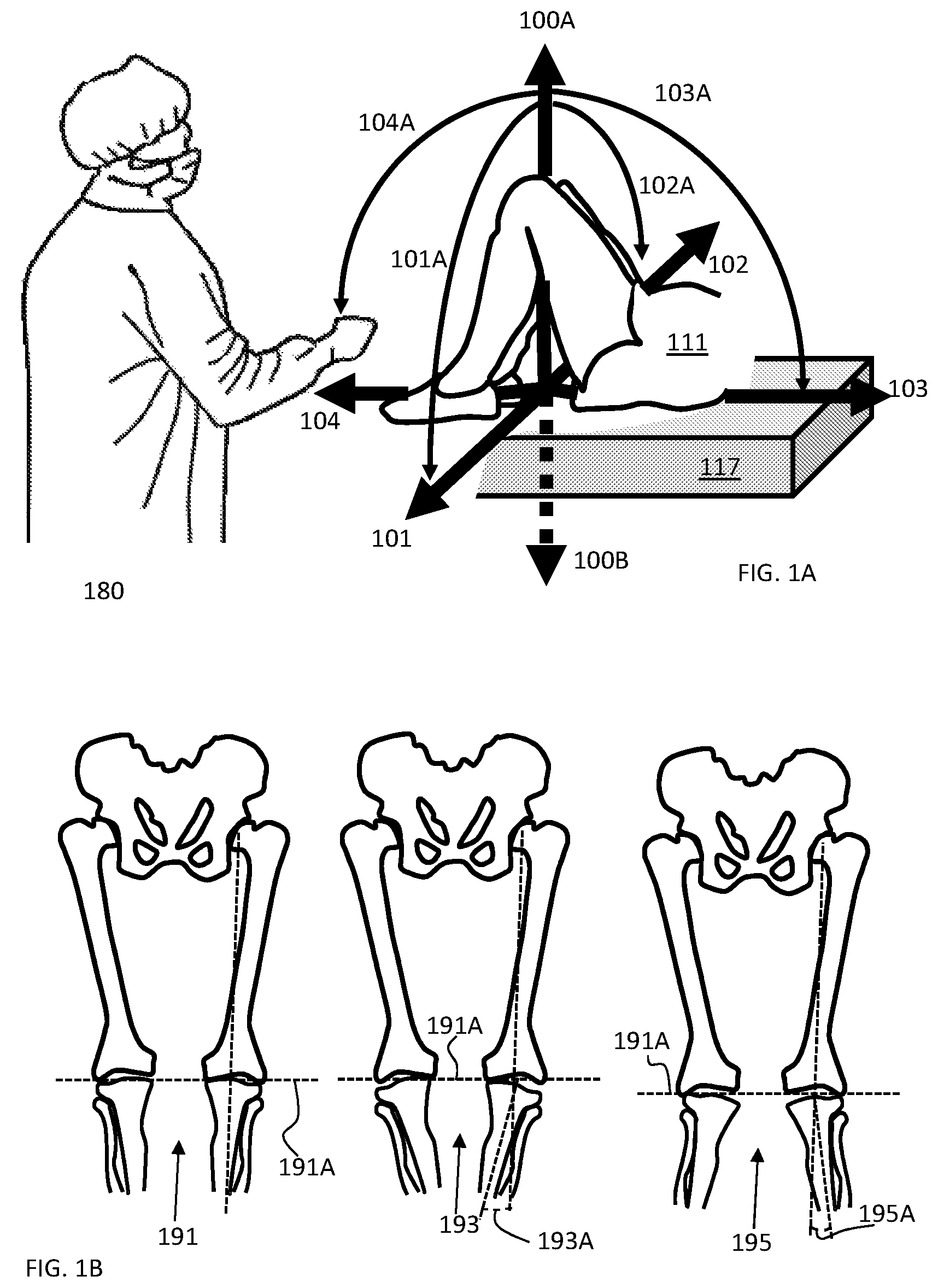 Patent US11793424 — Kinetic assessment and alignment of the muscular-skeletal system and method therefor — Figure 1