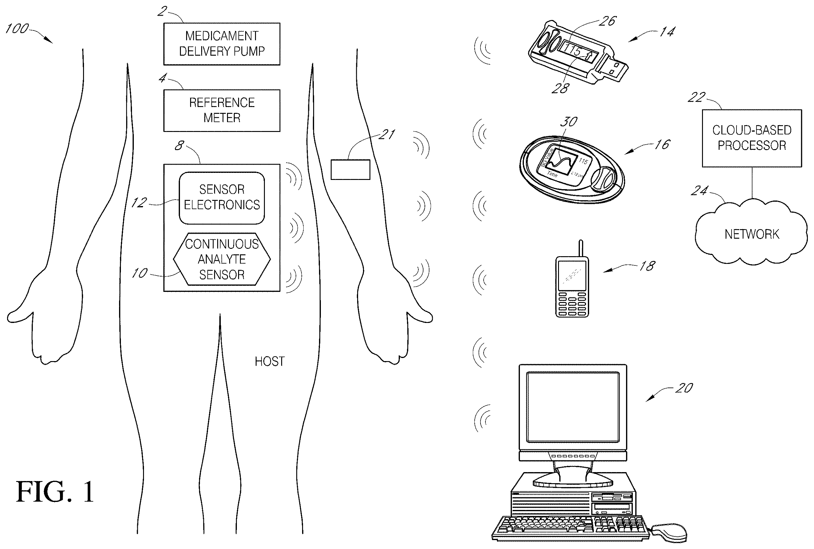 Patent US11793428 — Indicator and analytics for sensor insertion in a continuous analyte monitoring system and related methods — Figure 1