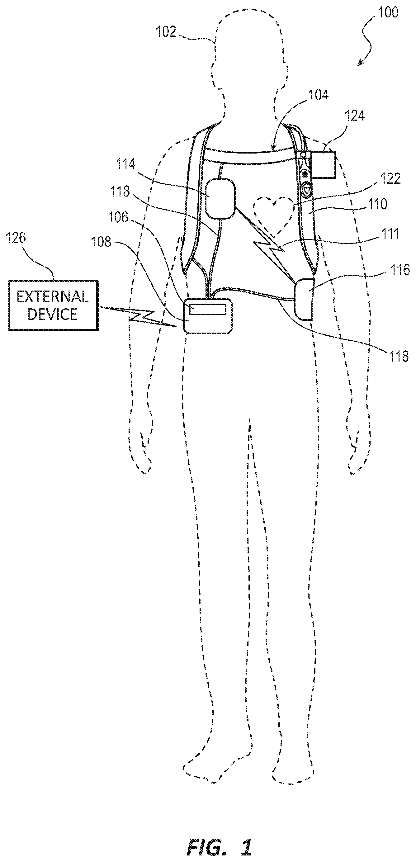 Patent US11793440 — Method to detect noise in a wearable cardioverter defibrillator — Figure 1