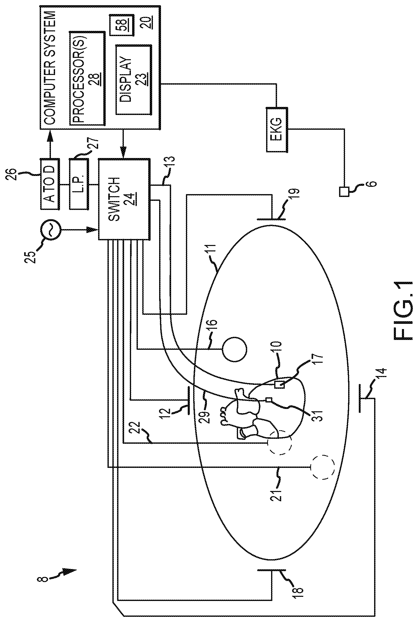 Patent US11793442 — System and method for mapping arrhythmic driver sites — Figure 1